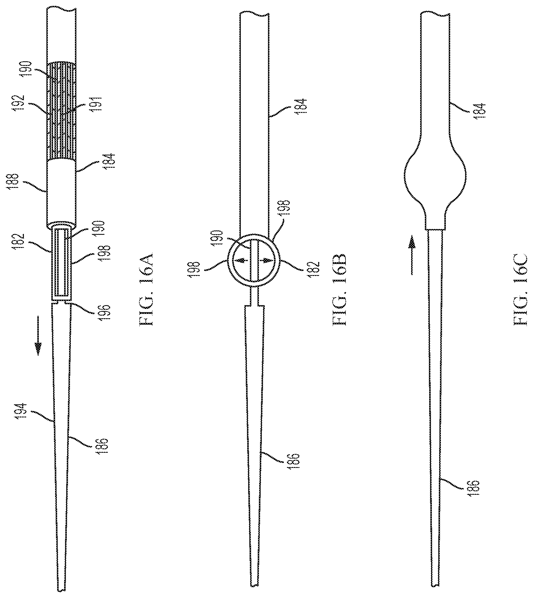 Patent US11779728 Figure 14 – Introducer sheath with expandable introducer