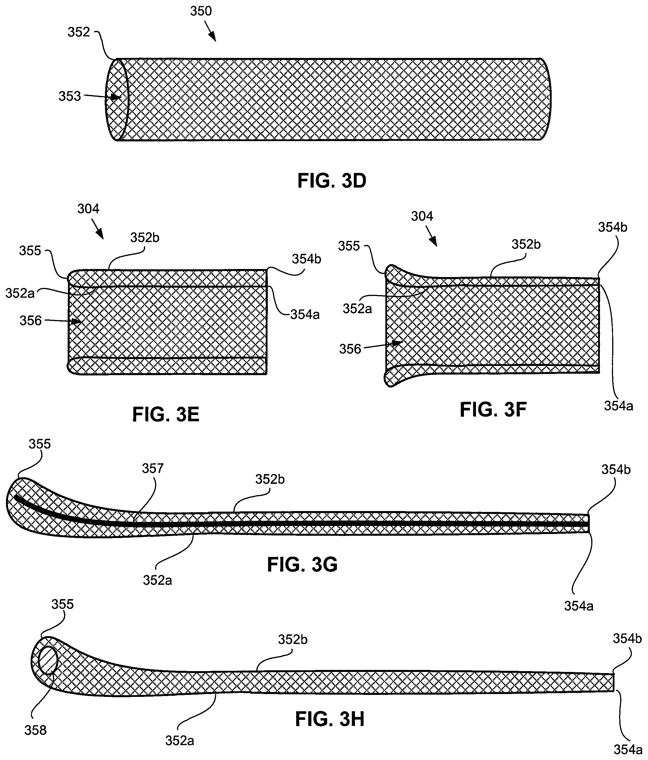 Patent US11779731 Figure 6 – Delivery catheter systems and methods
