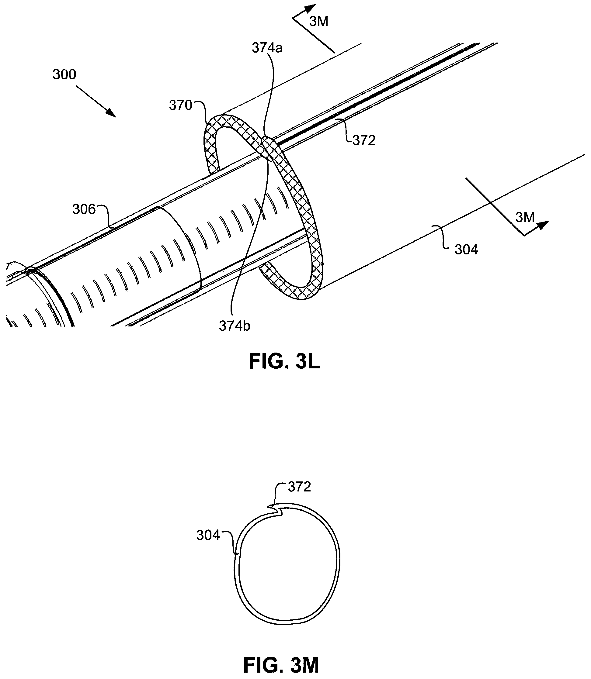 Patent US11779731 Figure 8 – Delivery catheter systems and methods