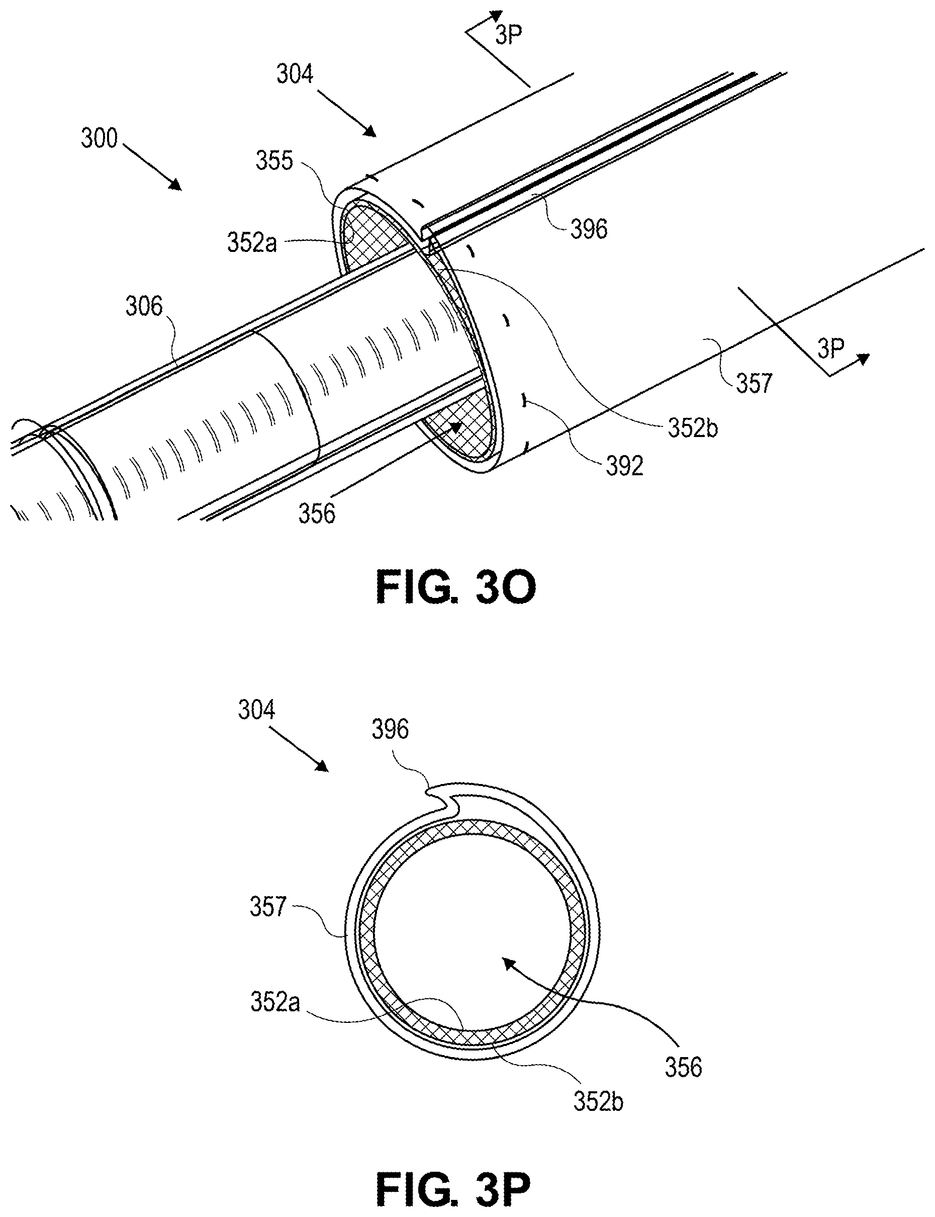 Patent US11779731 Figure 10 – Delivery catheter systems and methods