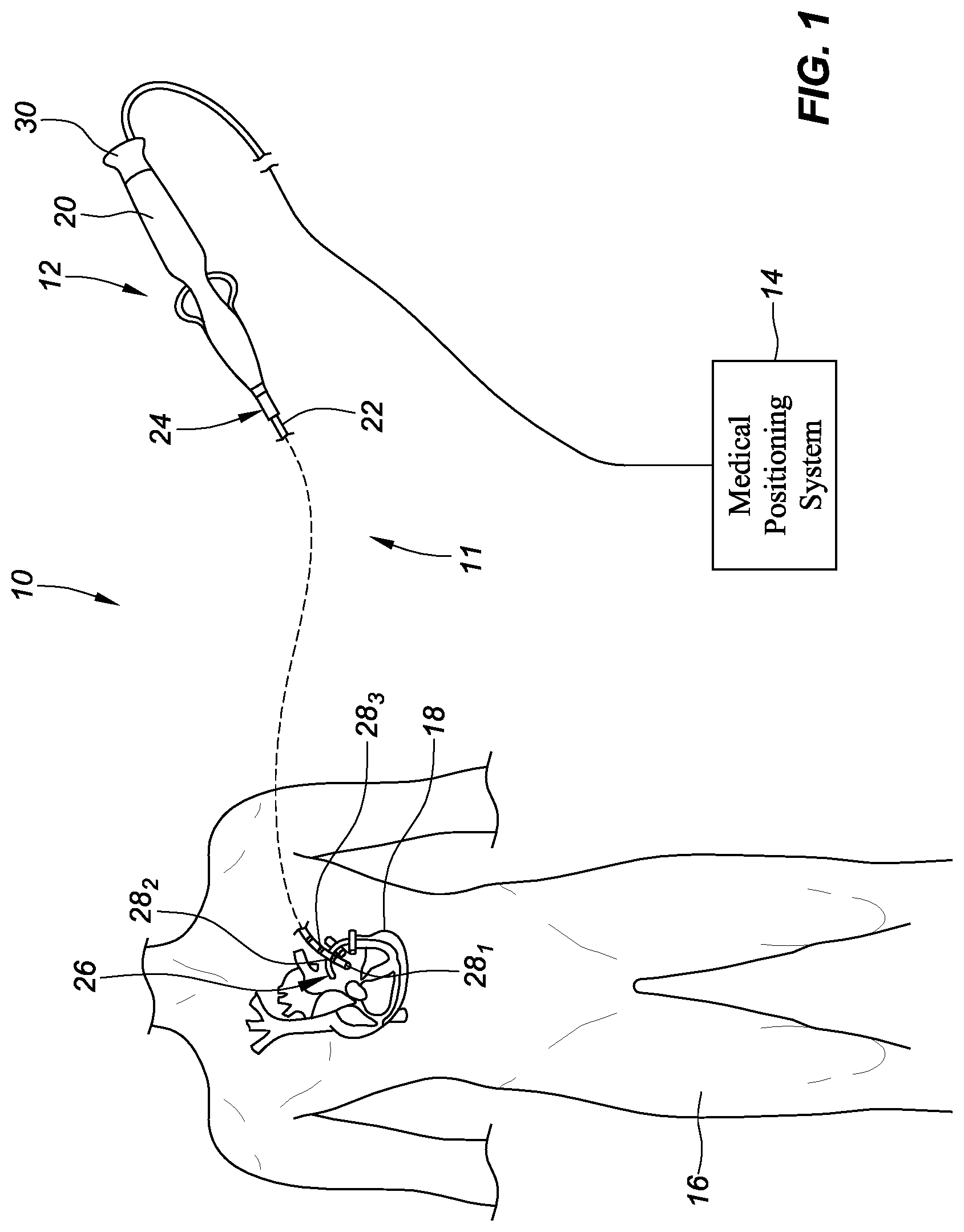 Patent US11779732 Figure 1 – Medical device sensor