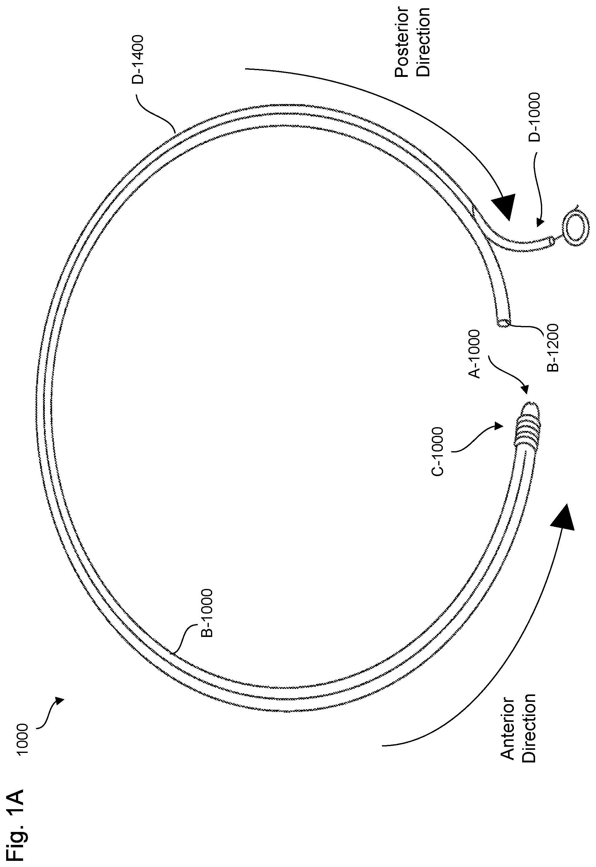 Patent US11779736 Figure 1 – Adjustable neck catheter