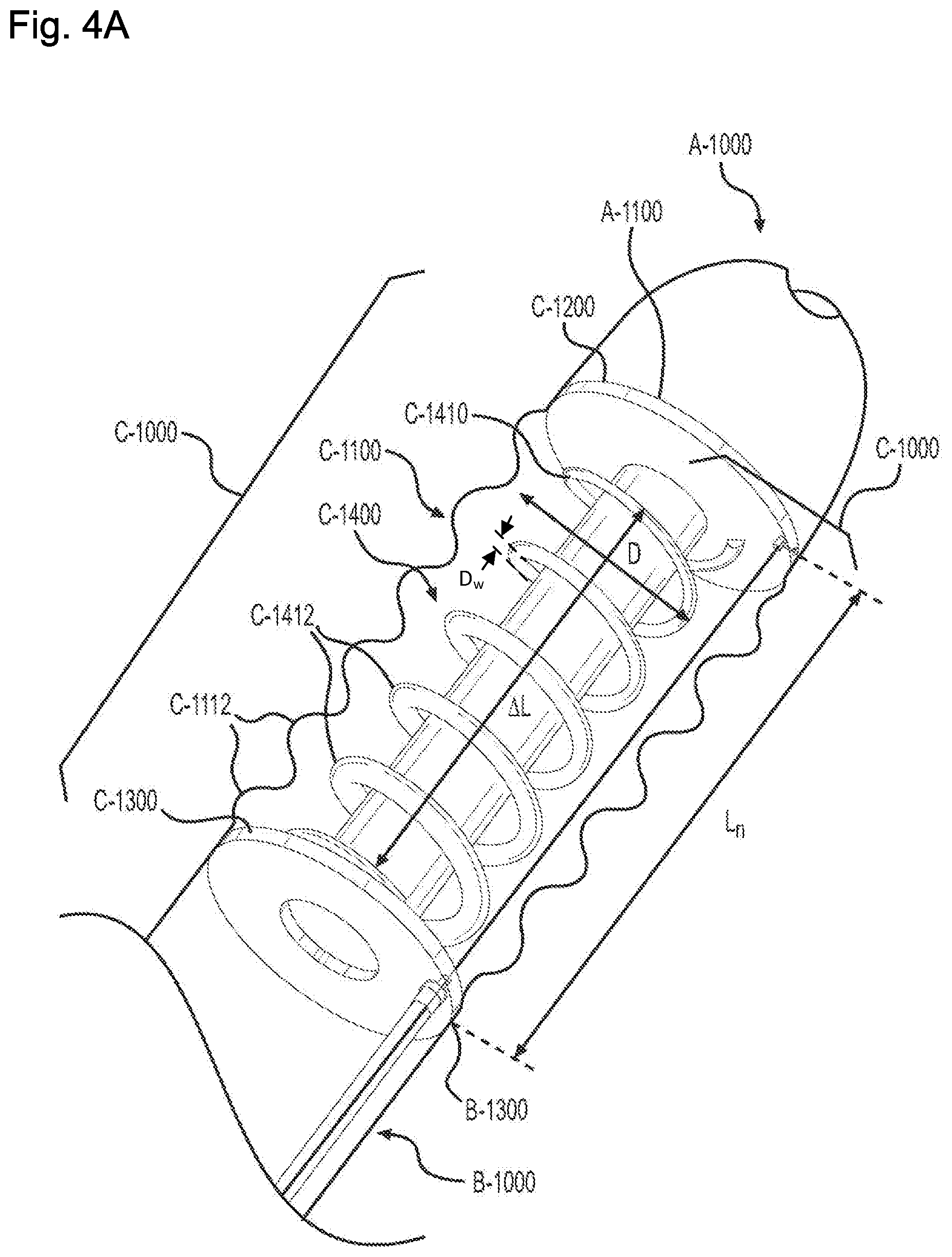 Patent US11779736 Figure 6 – Adjustable neck catheter
