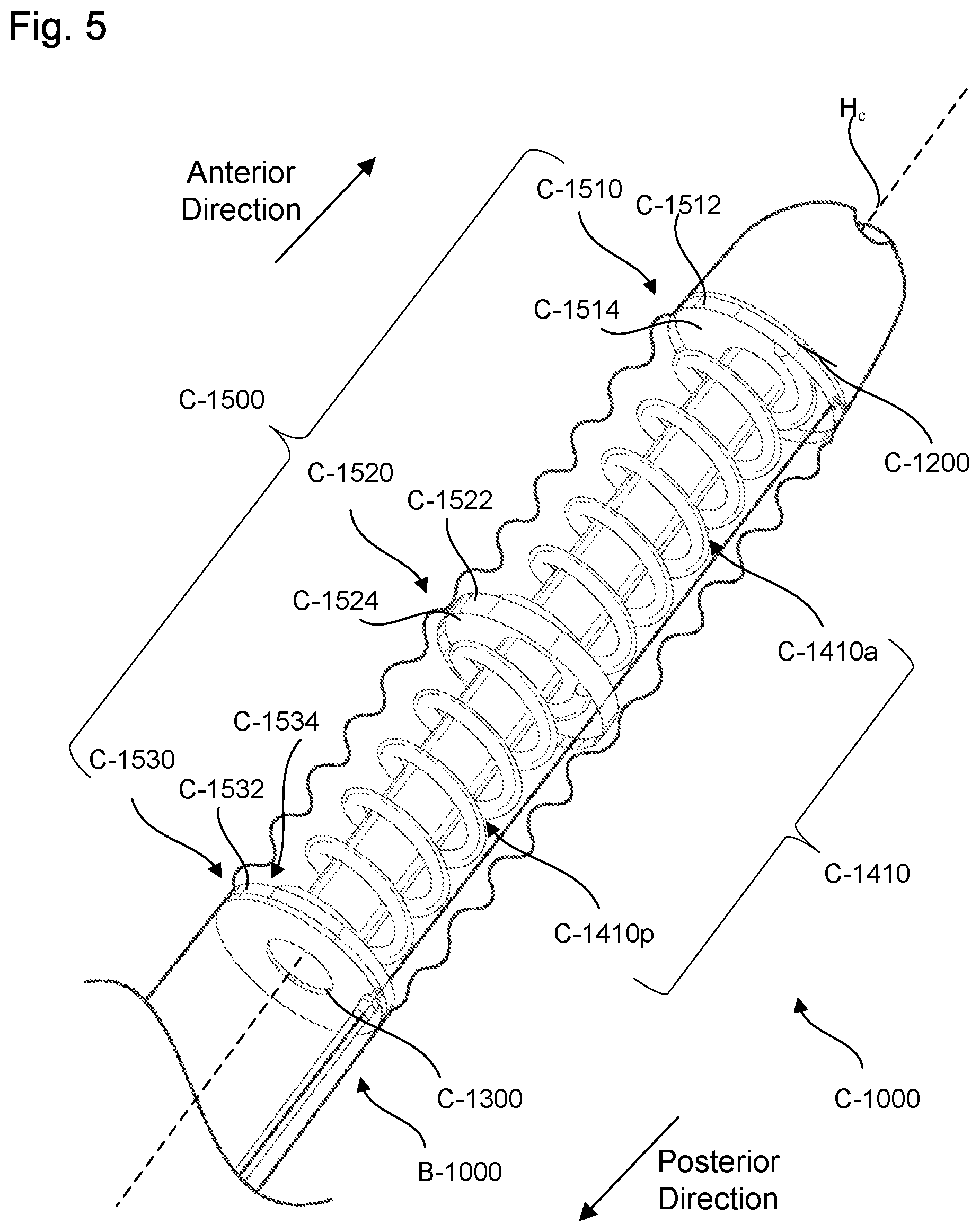 Patent US11779736 Figure 8 – Adjustable neck catheter