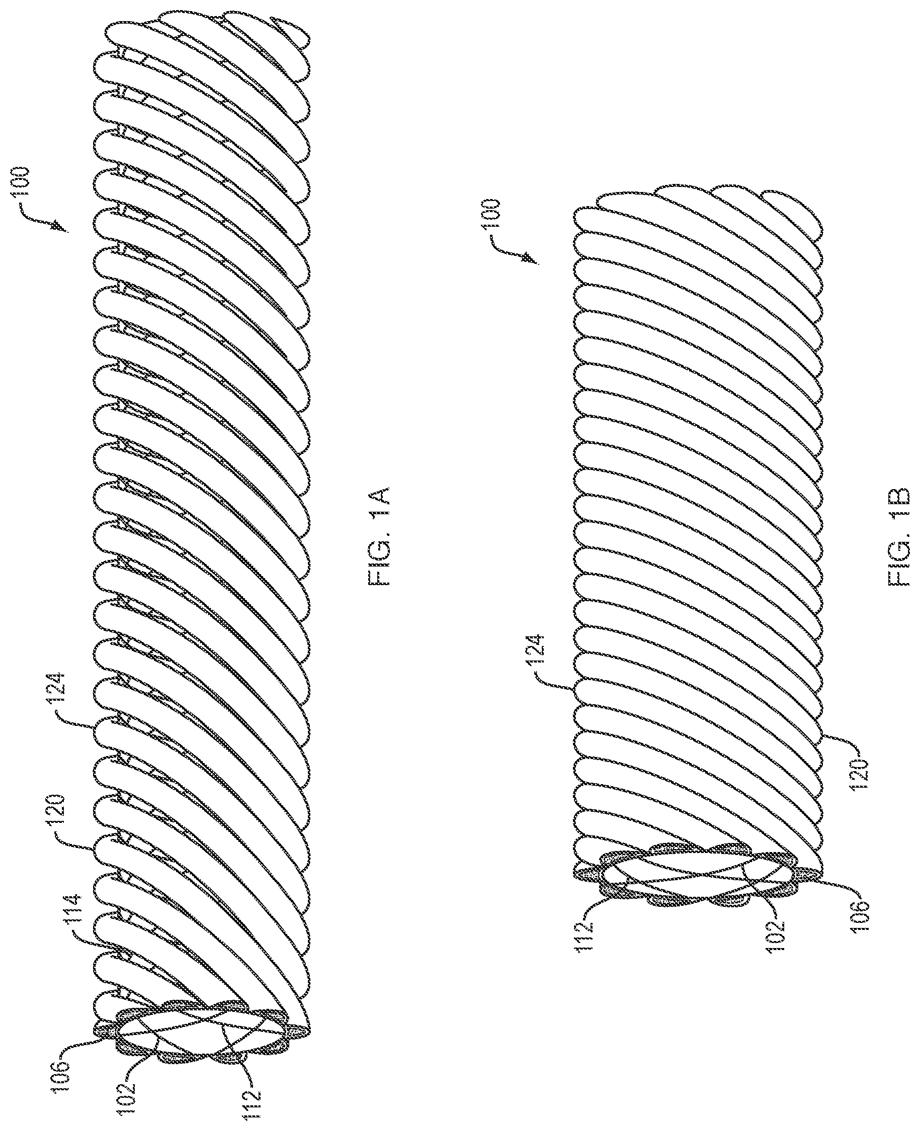 Patent US11779738 — Extracellular matrix delivery device — Figure 1