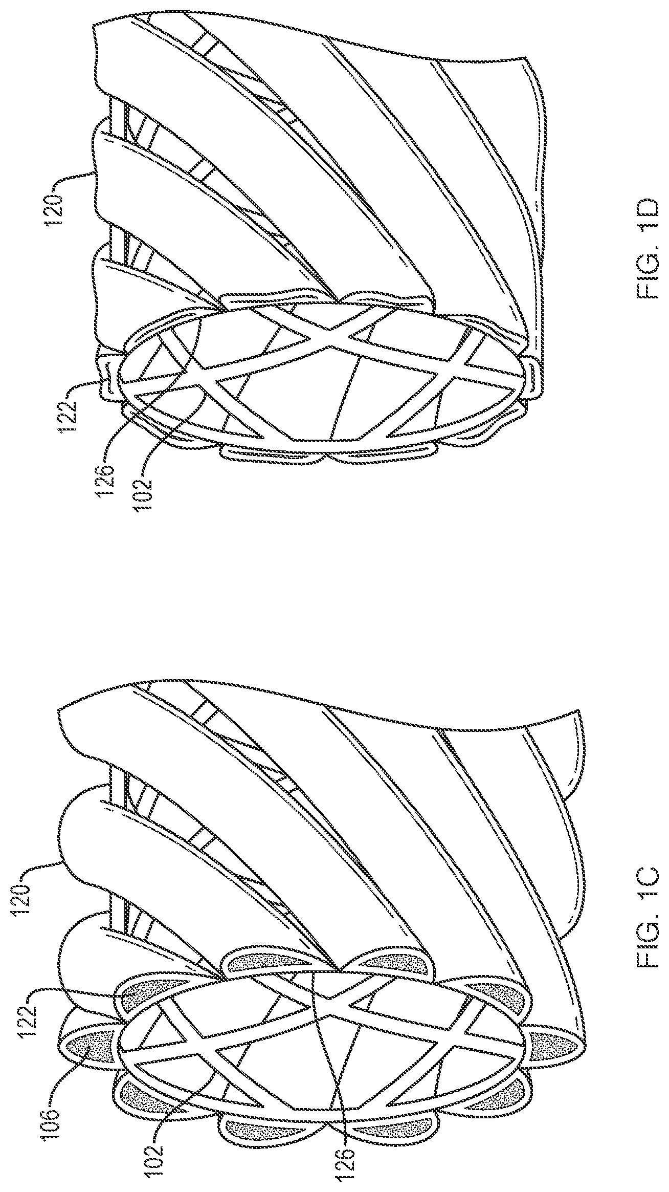 Patent US11779738 Figure 2 – Extracellular matrix delivery device