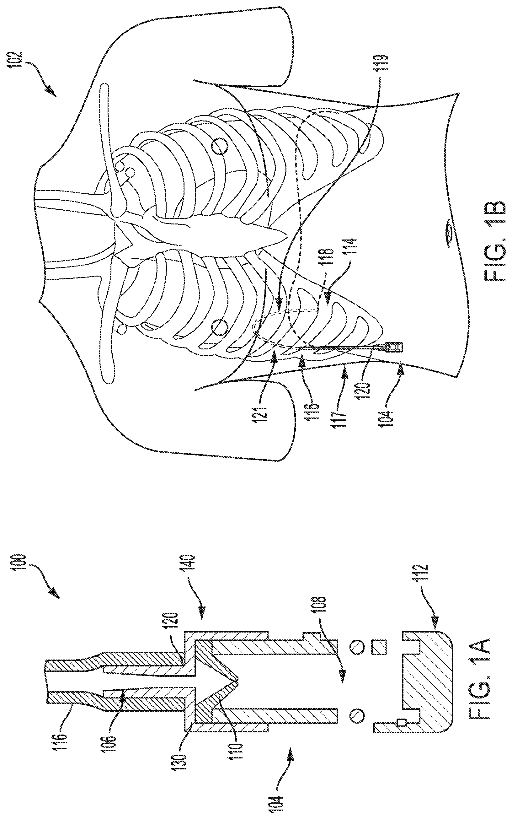 Patent US11779741 — Fluid-management system and method — Figure 1