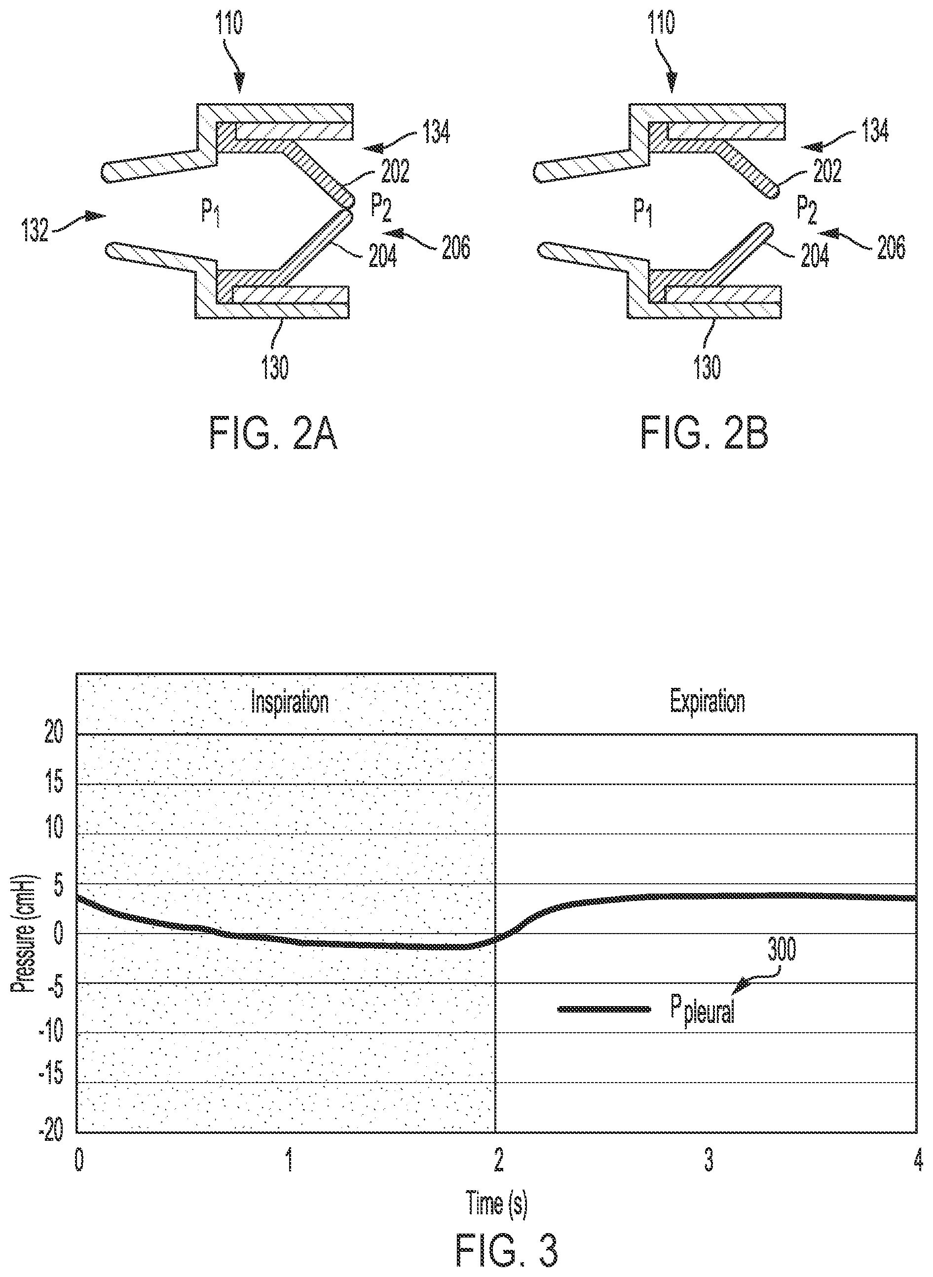 Patent US11779741 Figure 2 – Fluid-management system and method