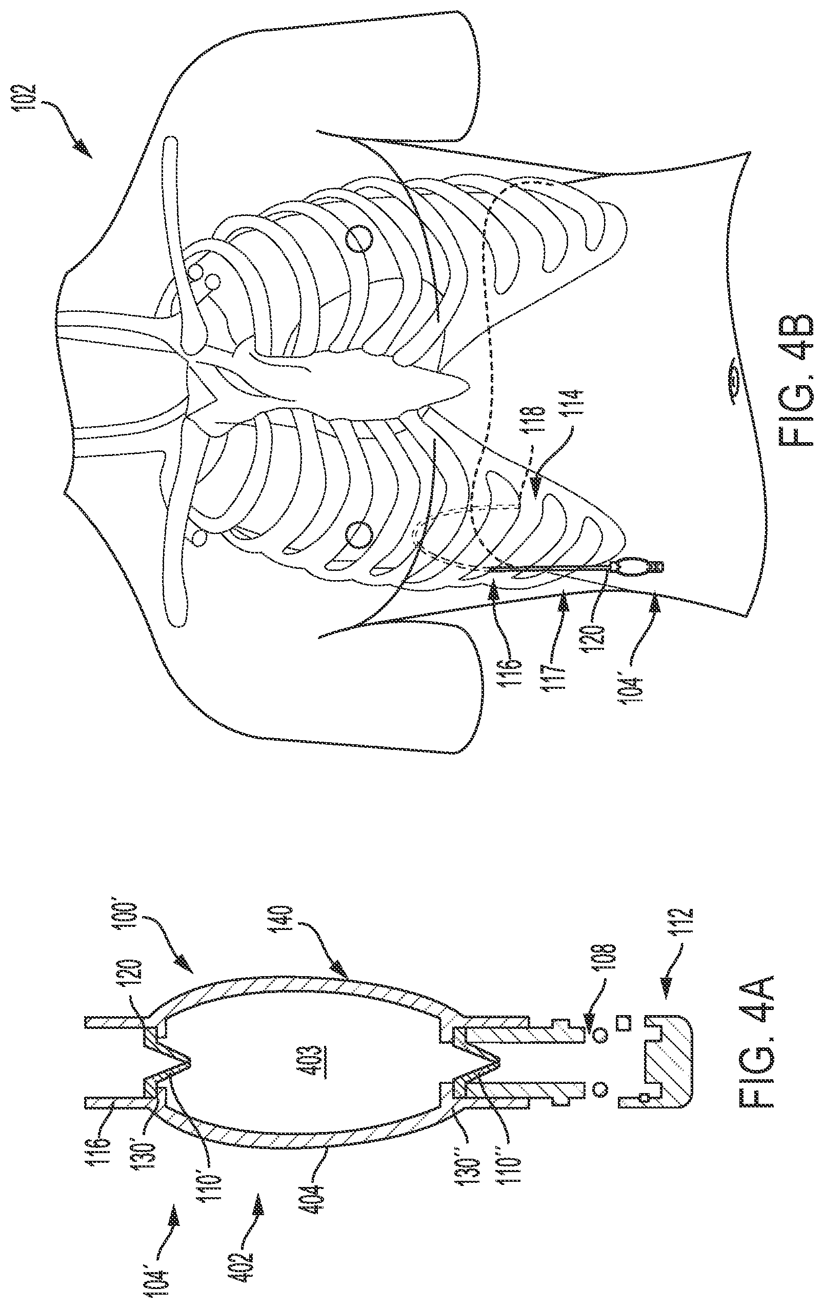 Patent US11779741 Figure 3 – Fluid-management system and method