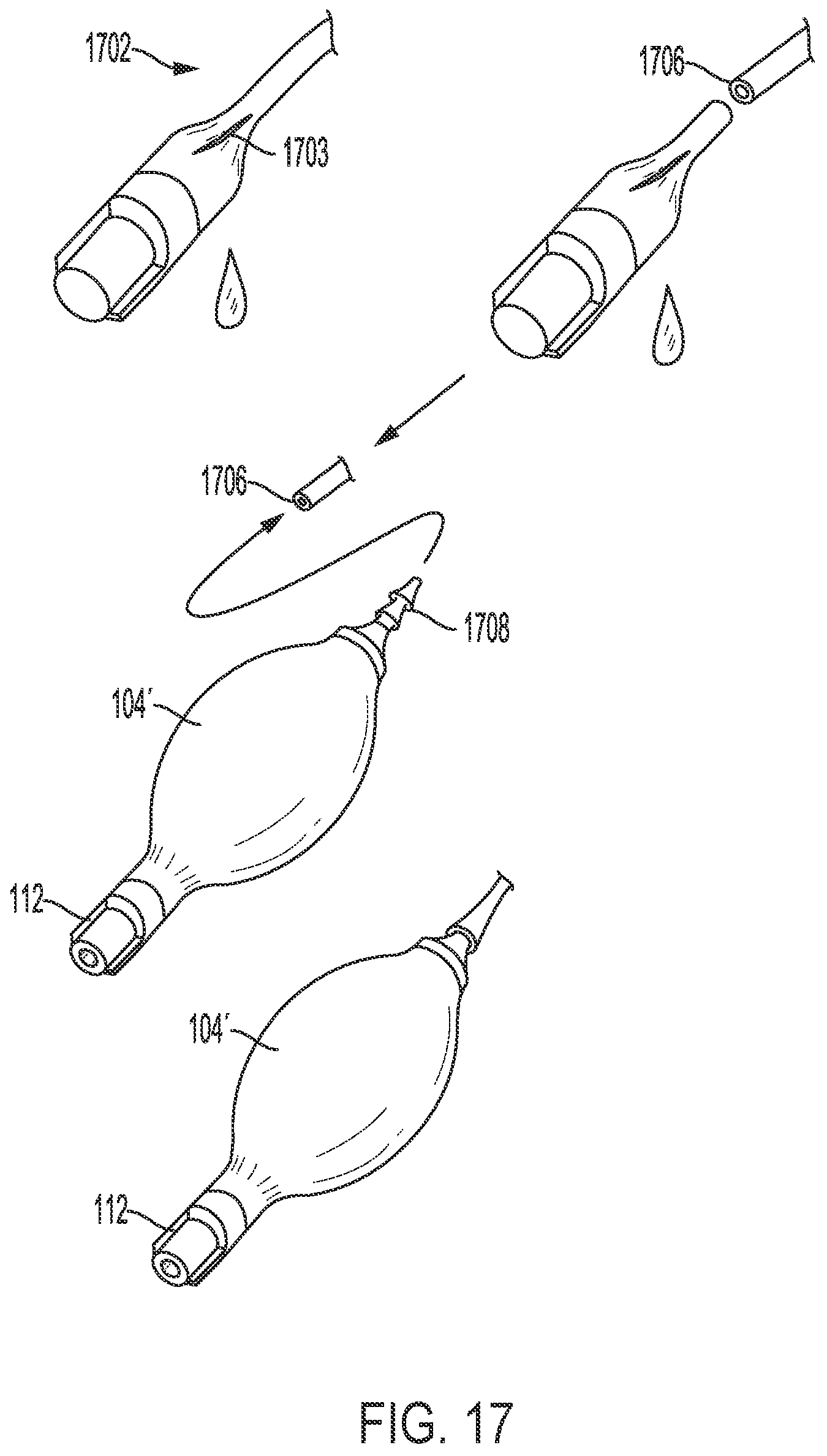 Patent US11779741 Figure 14 – Fluid-management system and method