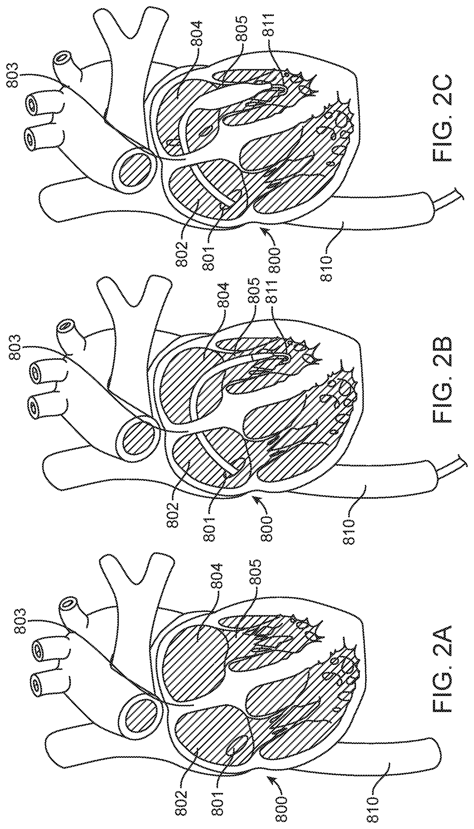 Patent US11779742 Figure 2 – Introducer with hemostasis mechanism