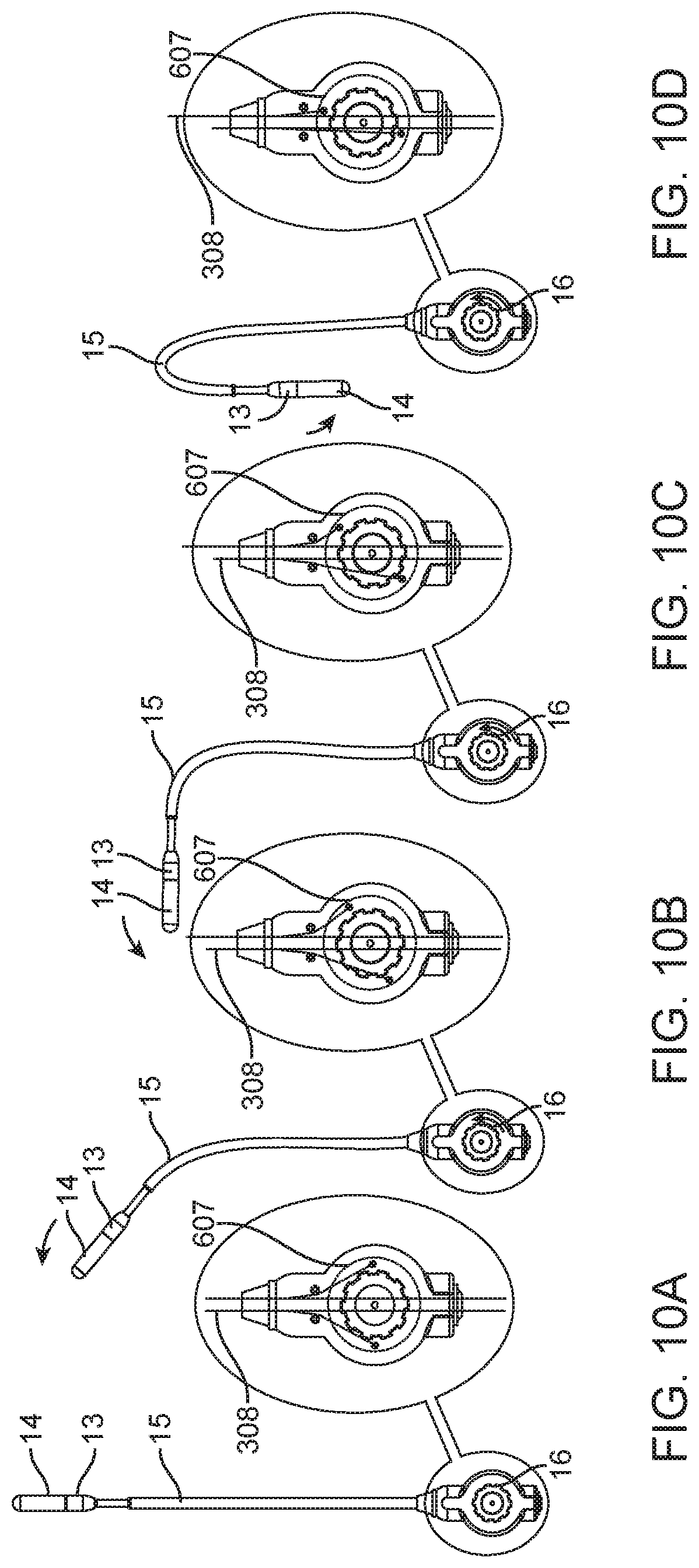 Patent US11779742 Figure 11 – Introducer with hemostasis mechanism