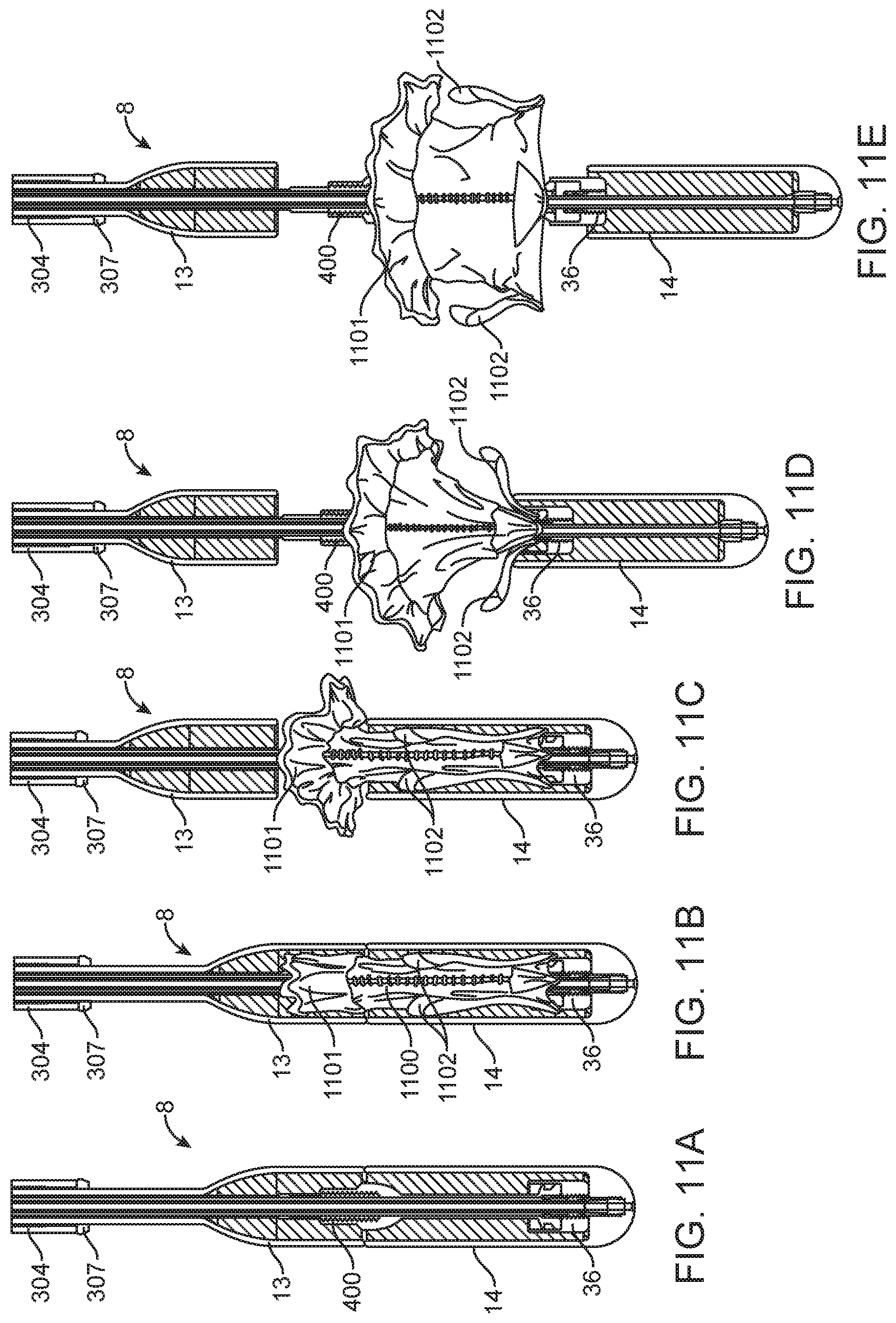 Patent US11779742 Figure 12 – Introducer with hemostasis mechanism