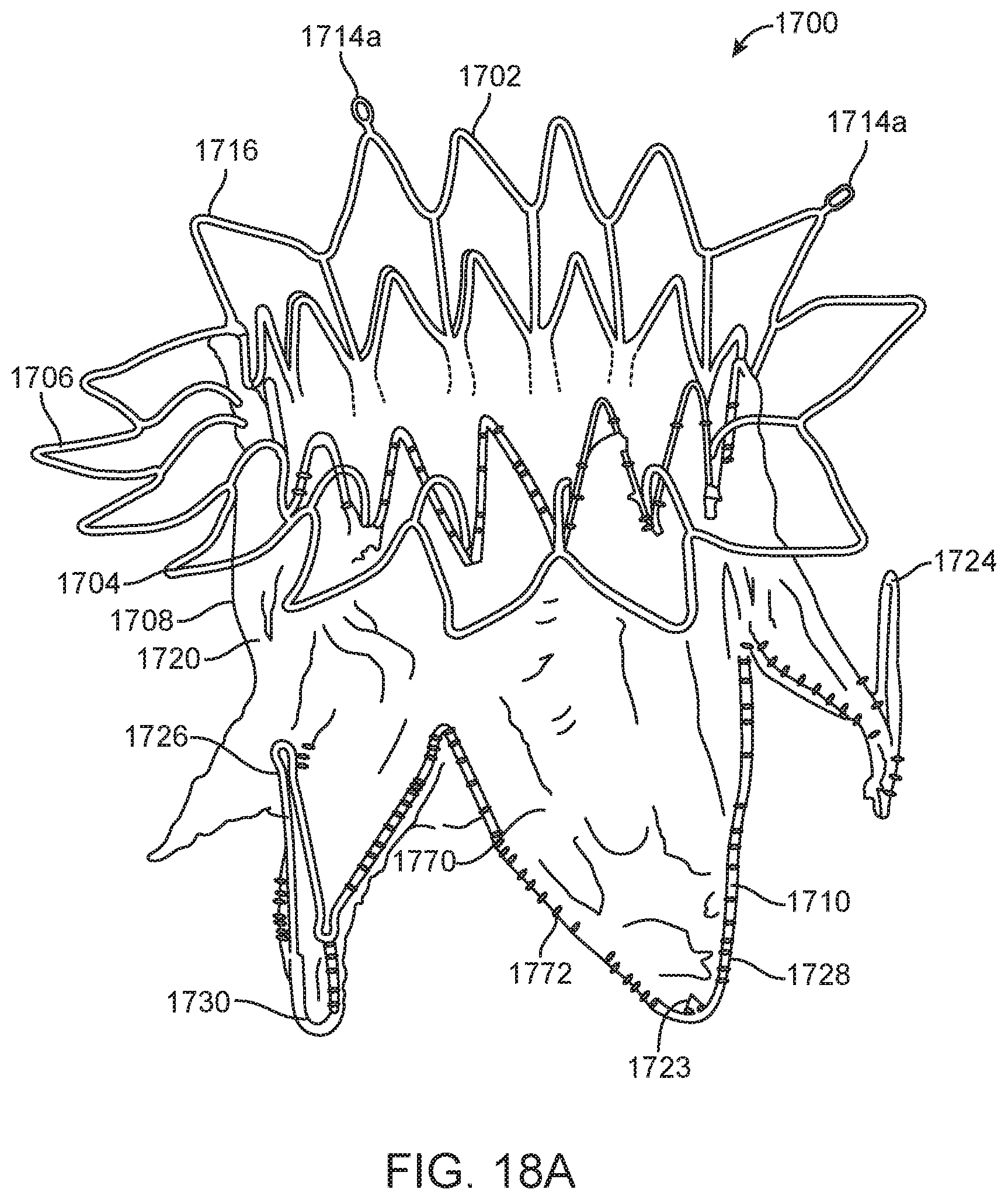 Patent US11779742 Figure 20 – Introducer with hemostasis mechanism