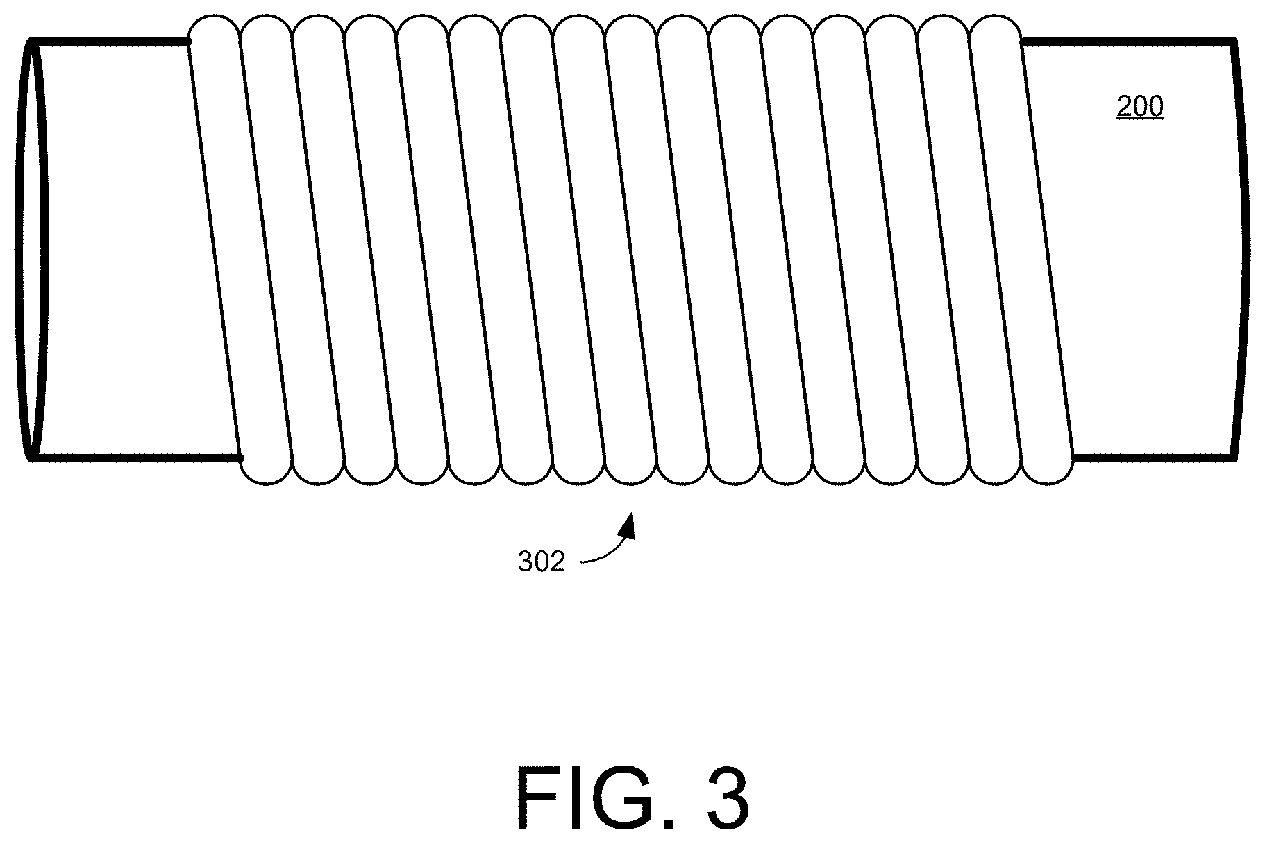 Patent US11779748 Figure 3 – Medical coiled tubing