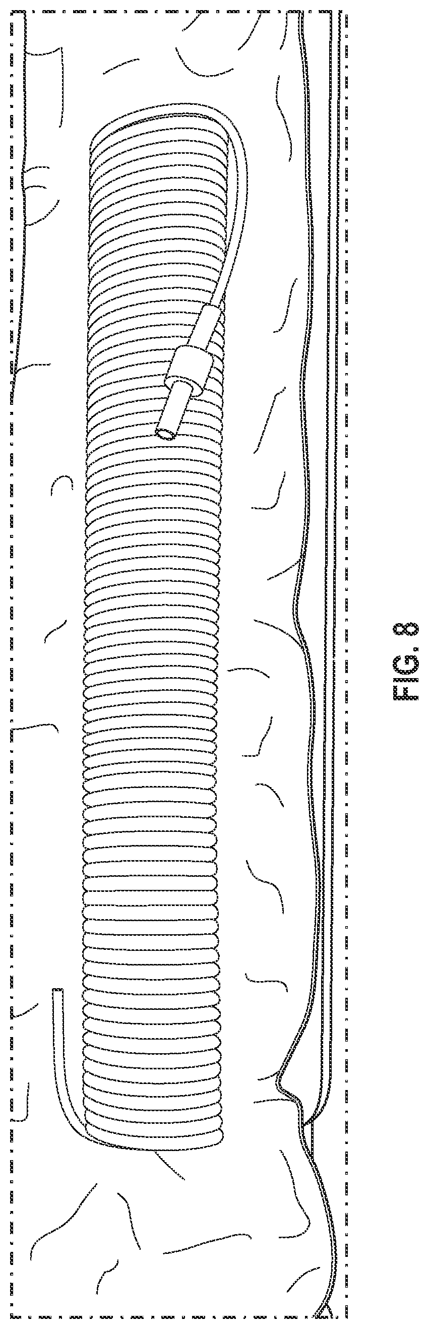 Patent US11779748 Figure 8 – Medical coiled tubing