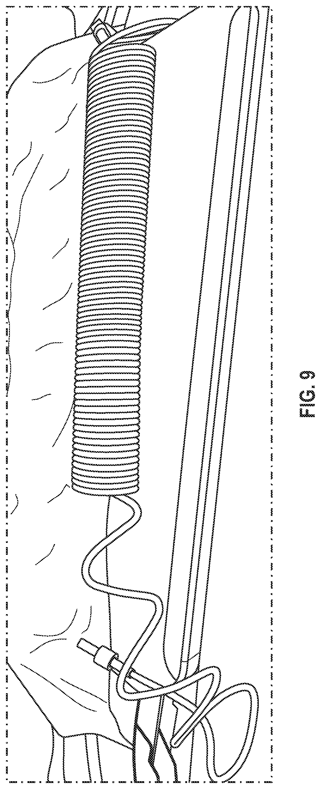 Patent US11779748 Figure 9 – Medical coiled tubing