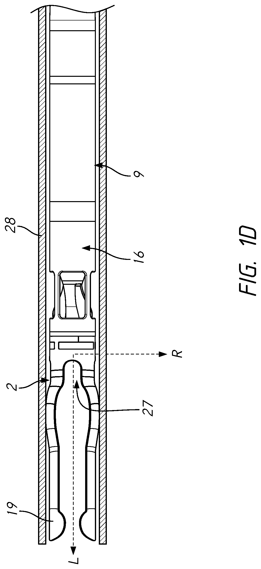 Patent US11779751 Figure 3 – Blood pumps