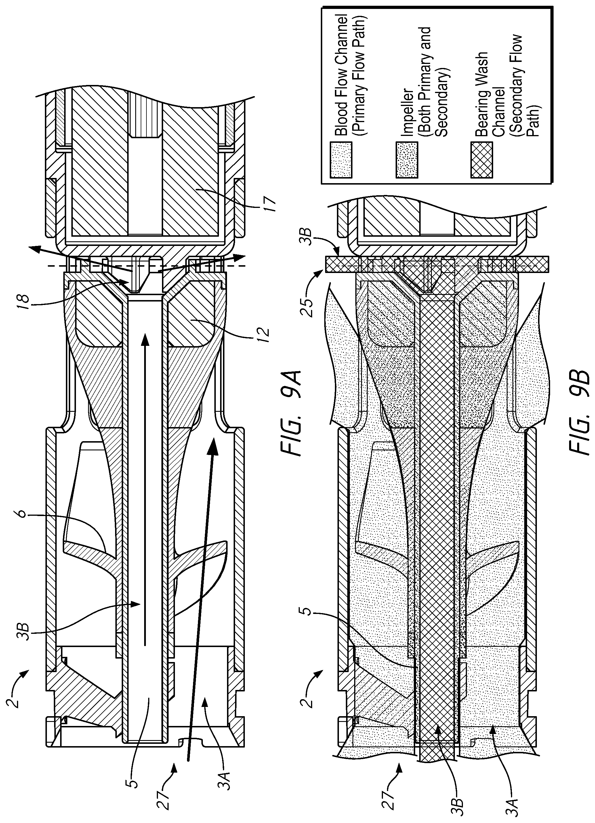 Patent US11779751 Figure 16 – Blood pumps