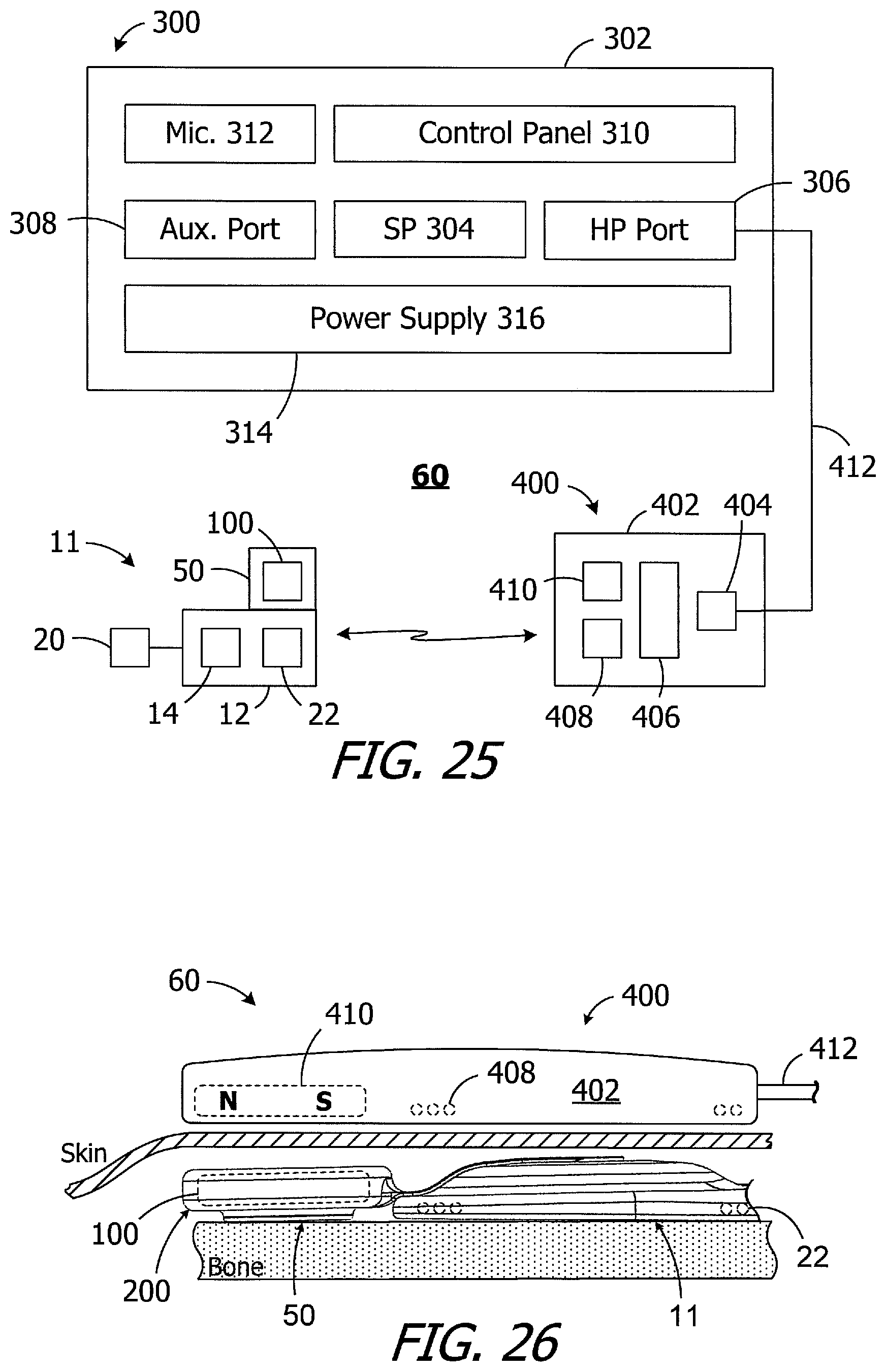 Patent US11779754 Figure 7 – Cochlear implants, magnets for use with same and magnet retrofit methods