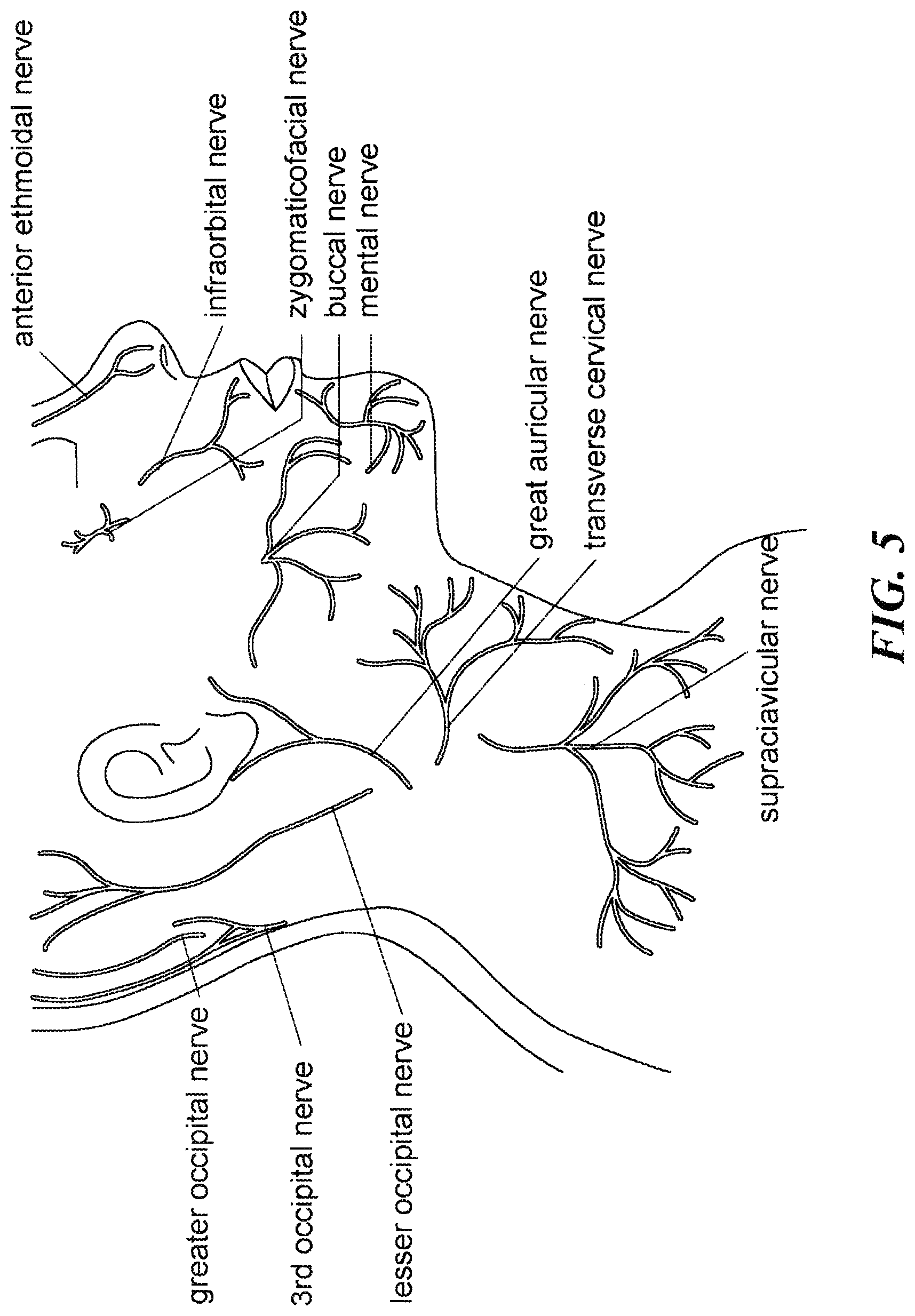 Patent US11779755 Figure 5 – System and methods for therapeutic stimulation