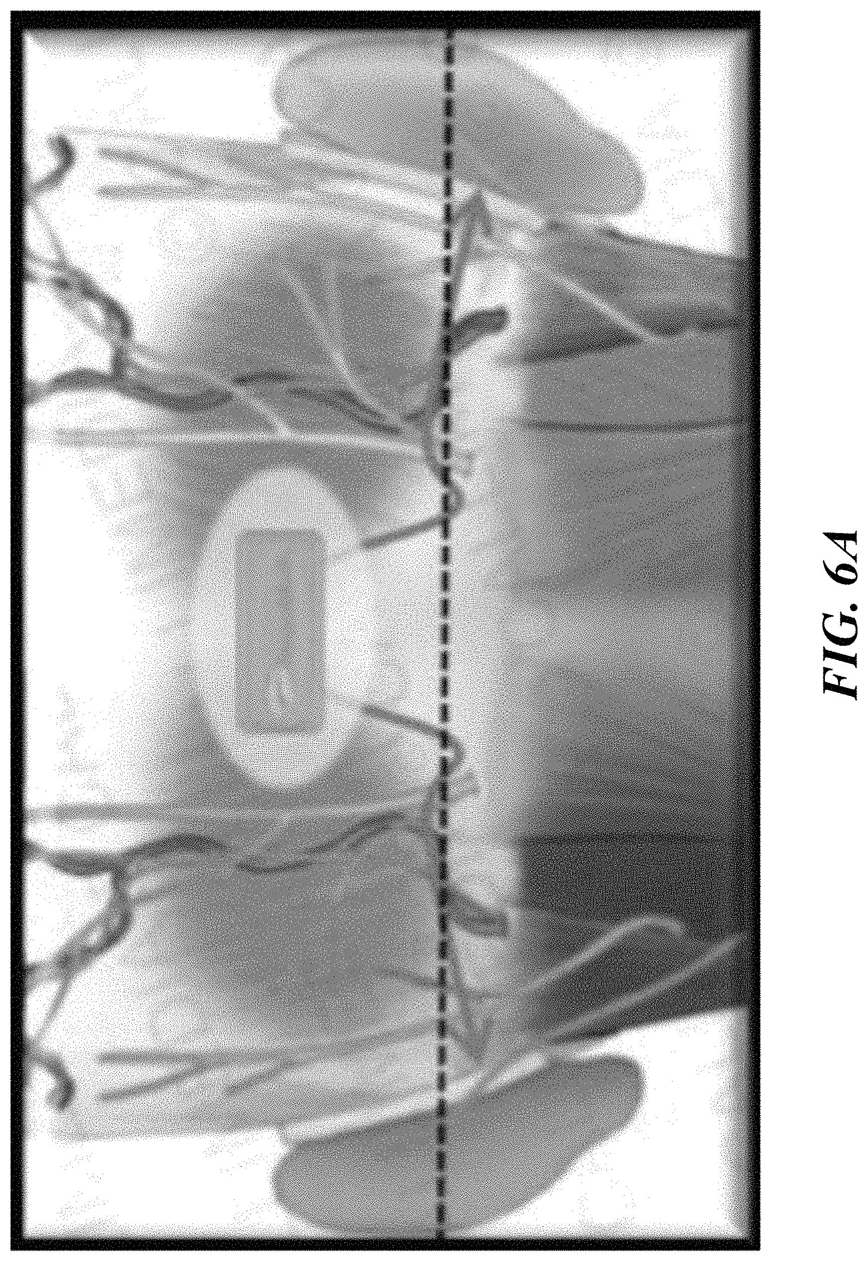 Patent US11779755 Figure 6 – System and methods for therapeutic stimulation