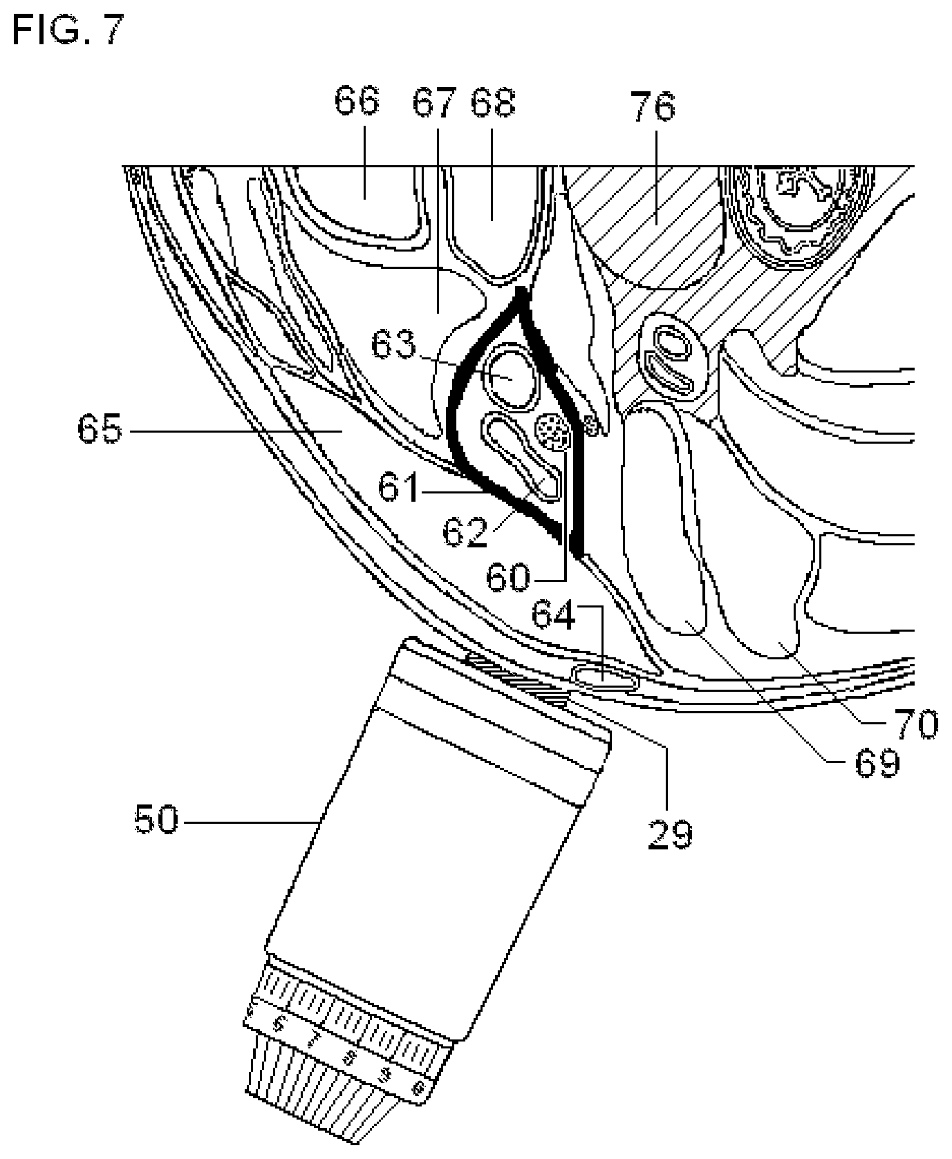 Patent US11779756 Figure 12 – Systems and methods for vagal nerve stimulation