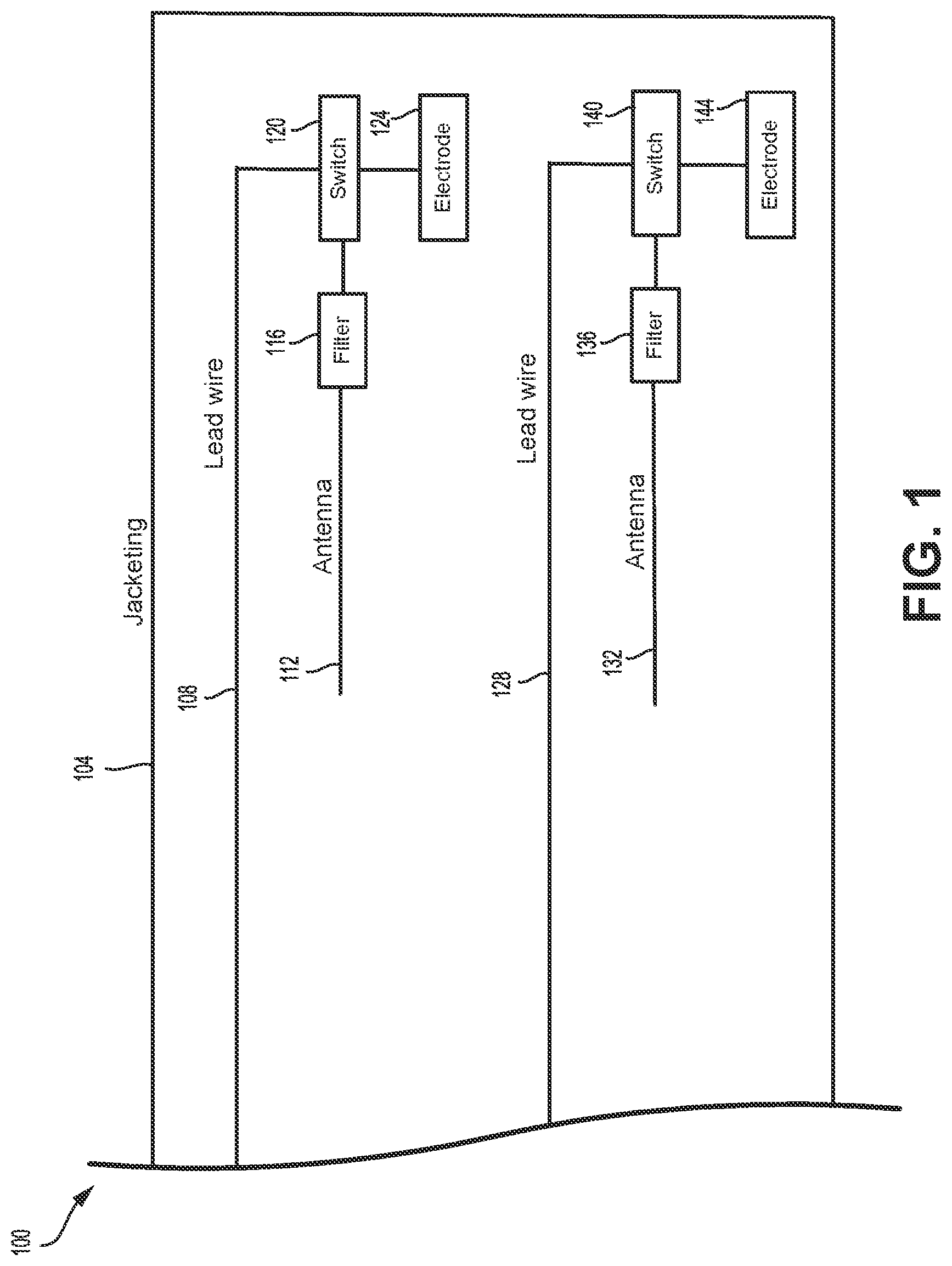 Patent US11779757 Figure 1 – MRI-compatible implantable medical devices
