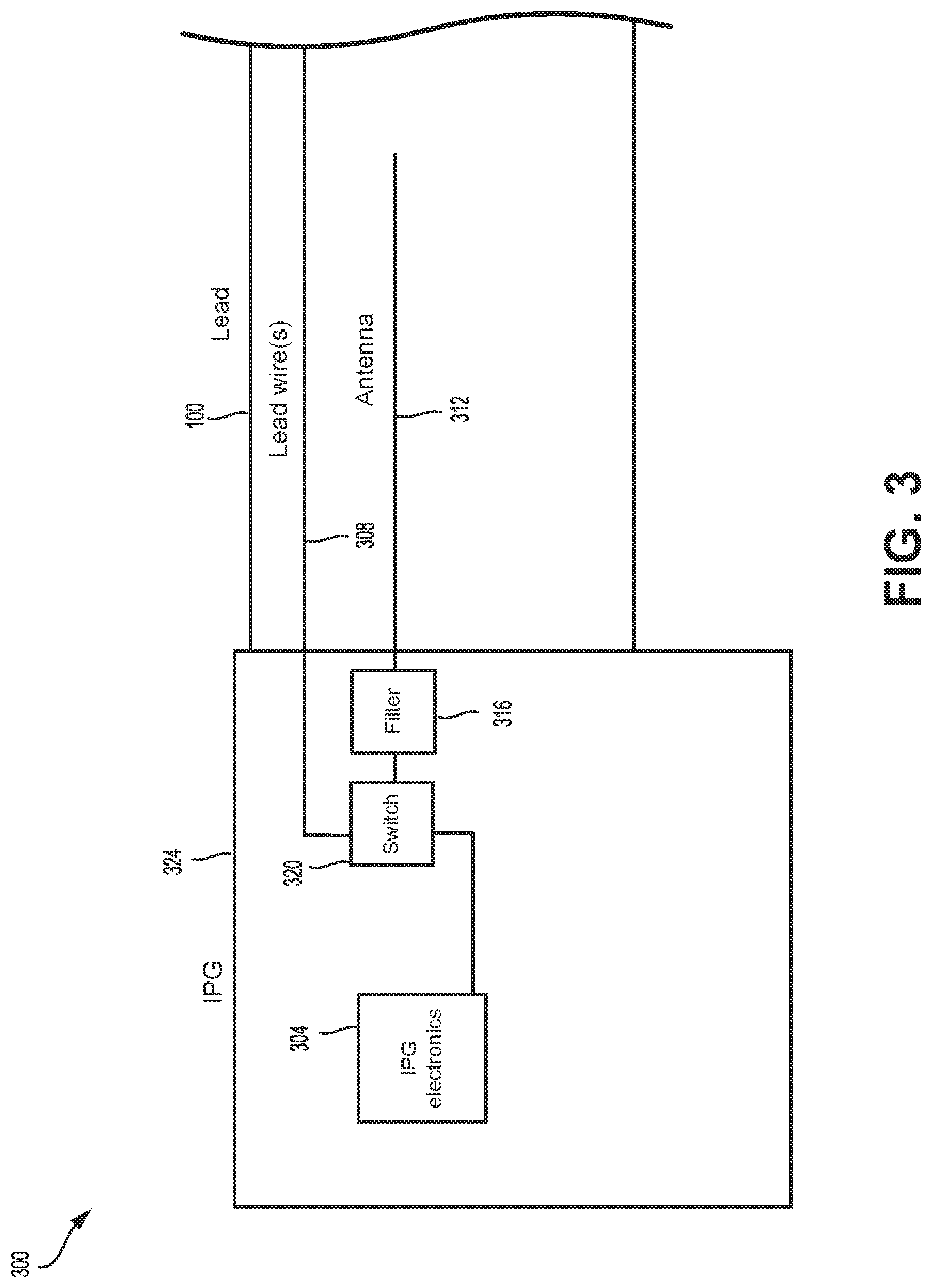 Patent US11779757 Figure 3 – MRI-compatible implantable medical devices