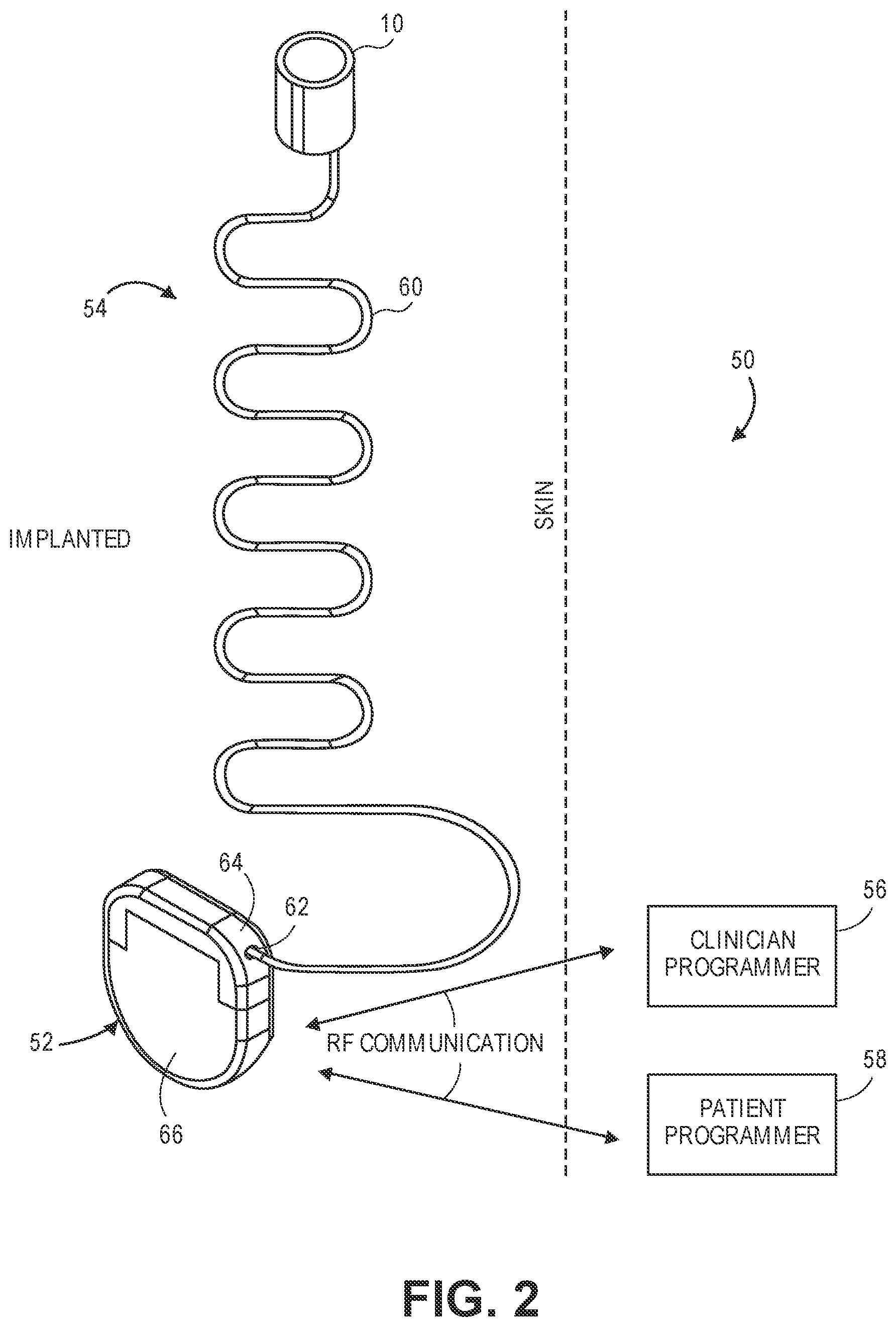 Patent US11779759 Figure 2 – Stimulator systems and methods for selectively recruiting fascicles in hypoglossal nerve trunk