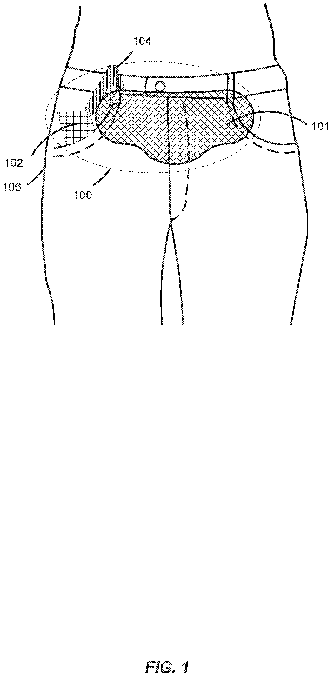 Patent US11779760 Figure 1 – Method and apparatus for portably treating muscular discomfort