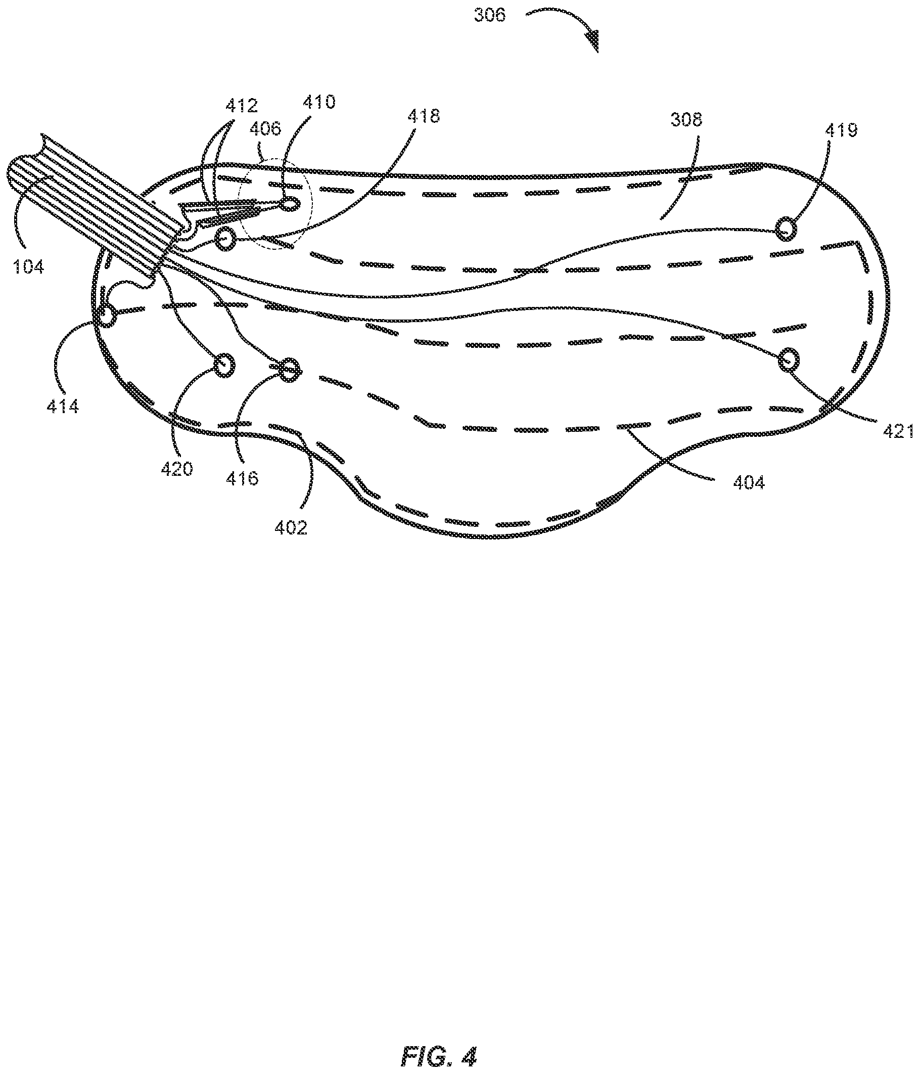 Patent US11779760 Figure 4 – Method and apparatus for portably treating muscular discomfort