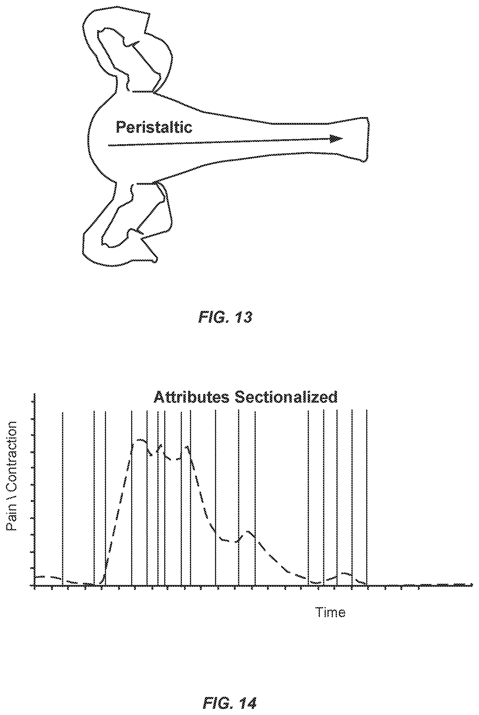 Patent US11779760 Figure 12 – Method and apparatus for portably treating muscular discomfort