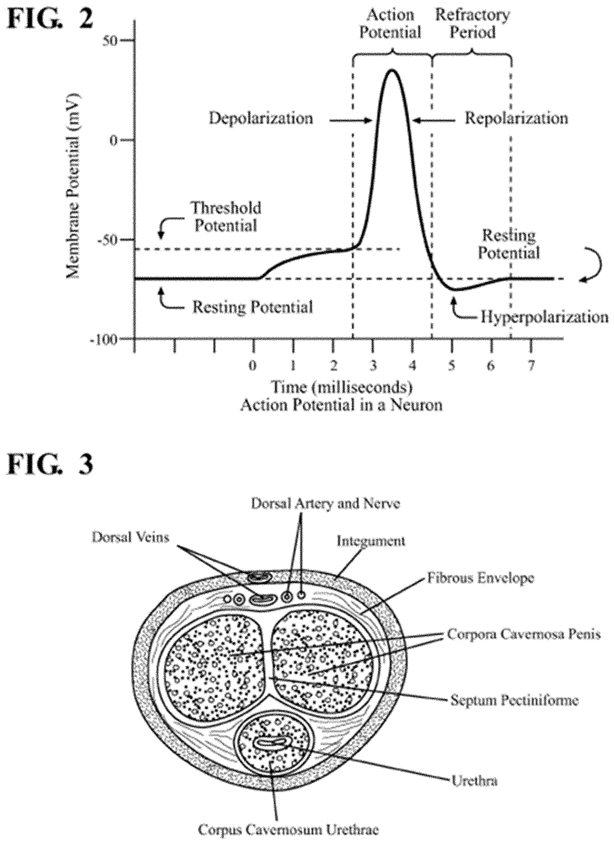 Patent US11779761 Figure 2 – Non-invasive nerve stimulation