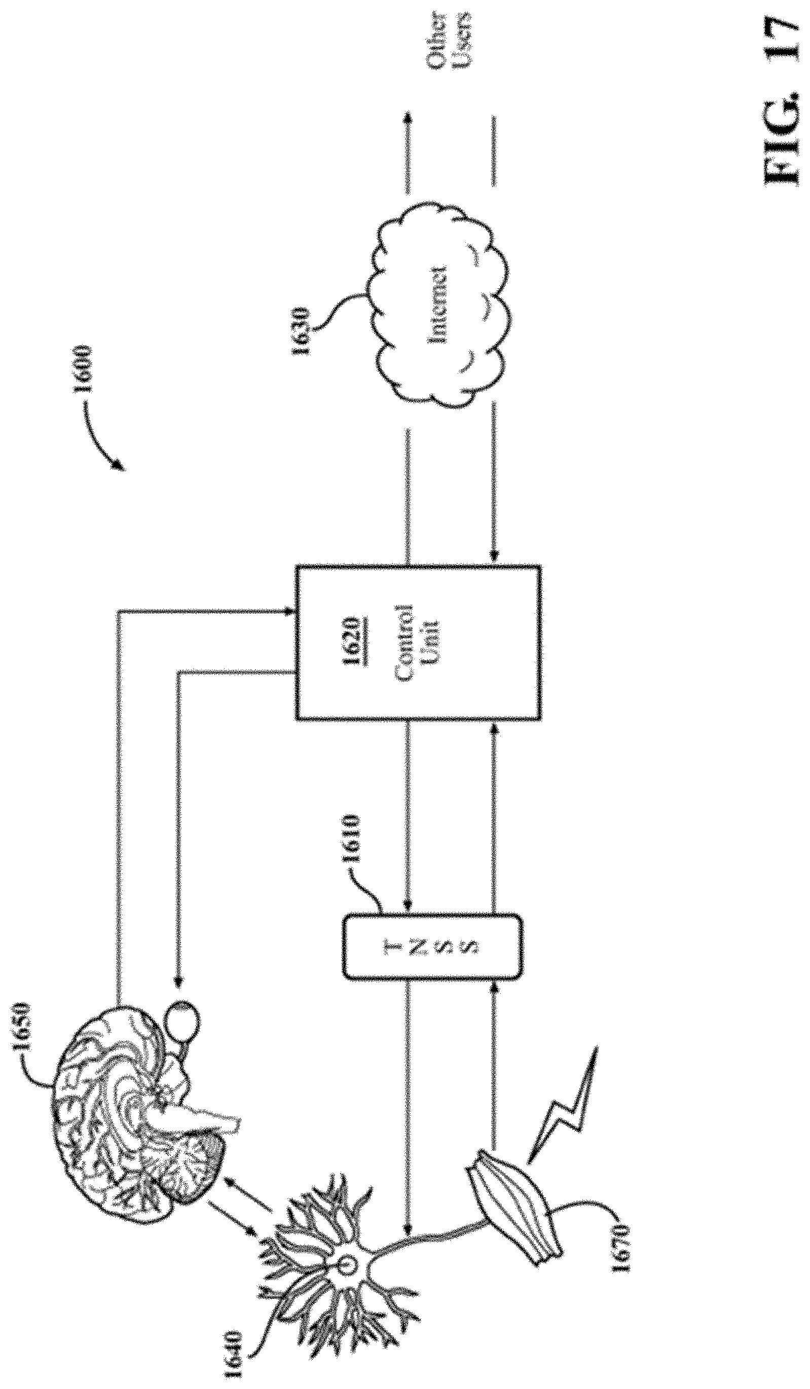 Patent US11779761 Figure 10 – Non-invasive nerve stimulation