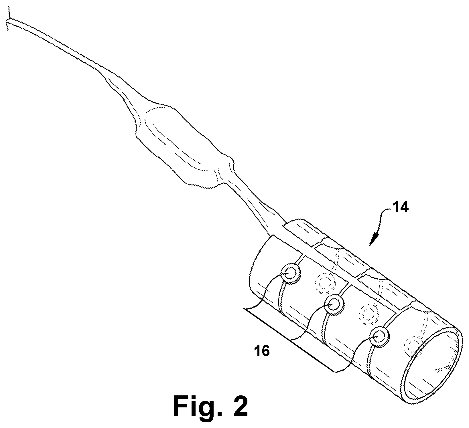 Patent US11779762 Figure 2 – Systems for treatment of a neurological disorder using electrical nerve conduction block