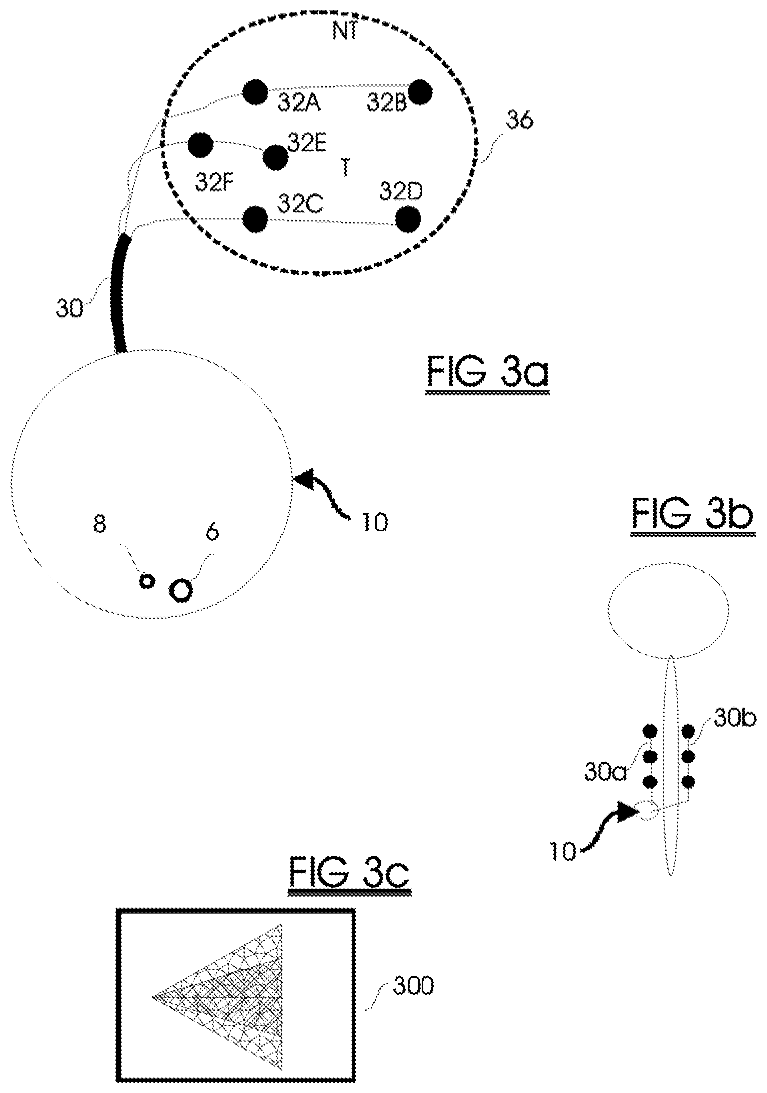 Patent US11779767 Figure 3 – Systems and methods for improved spinal cord stimulation