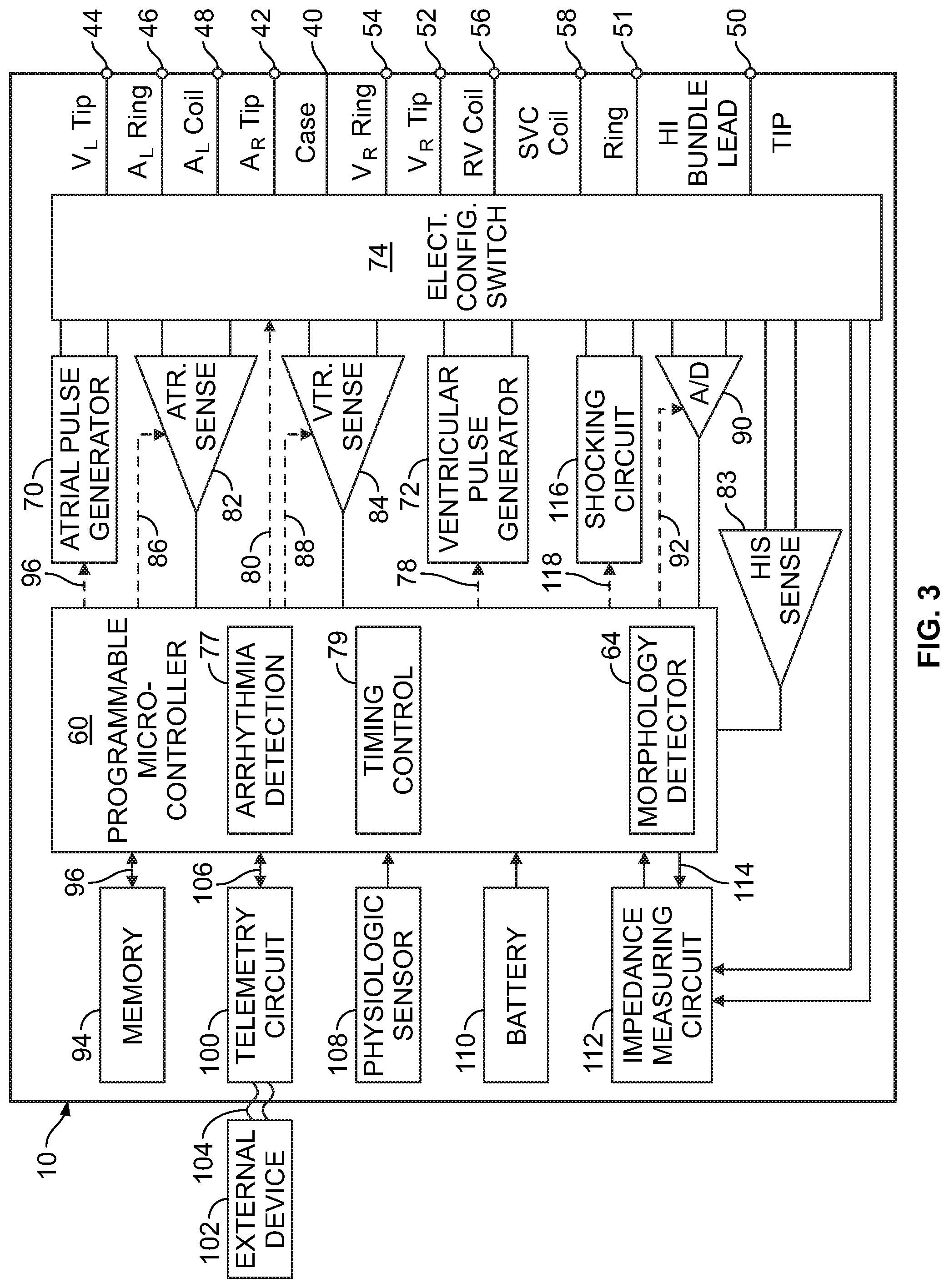 Patent US11779769 Figure 3 – Method and device for avoiding atrial activity oversensing on his sensing channel
