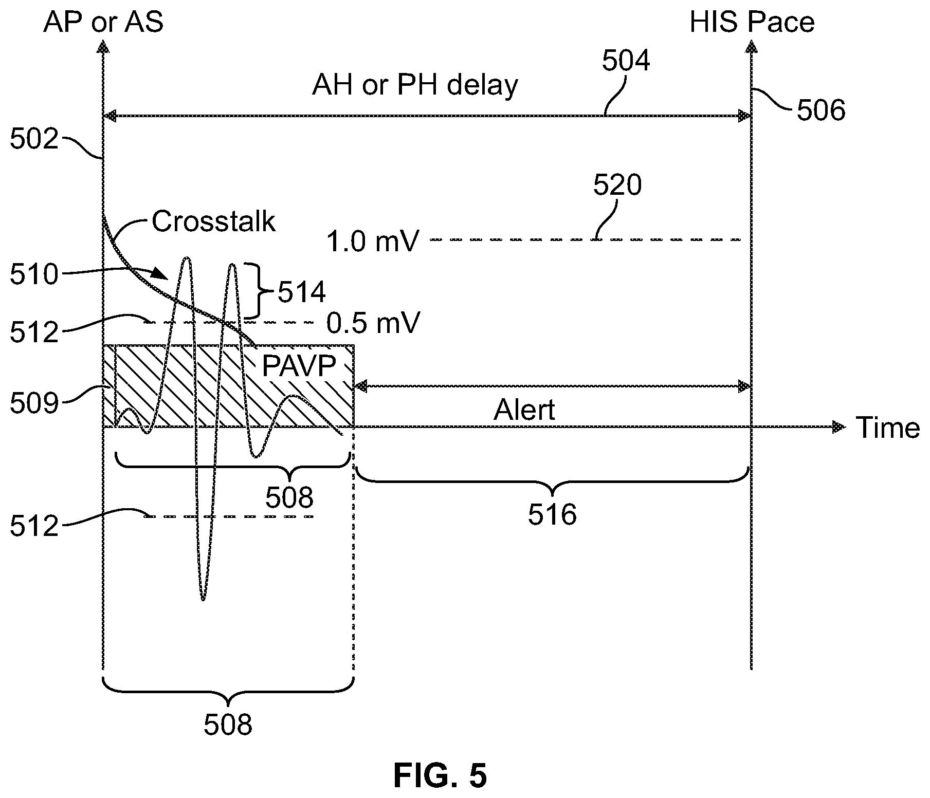 Patent US11779769 Figure 6 – Method and device for avoiding atrial activity oversensing on his sensing channel