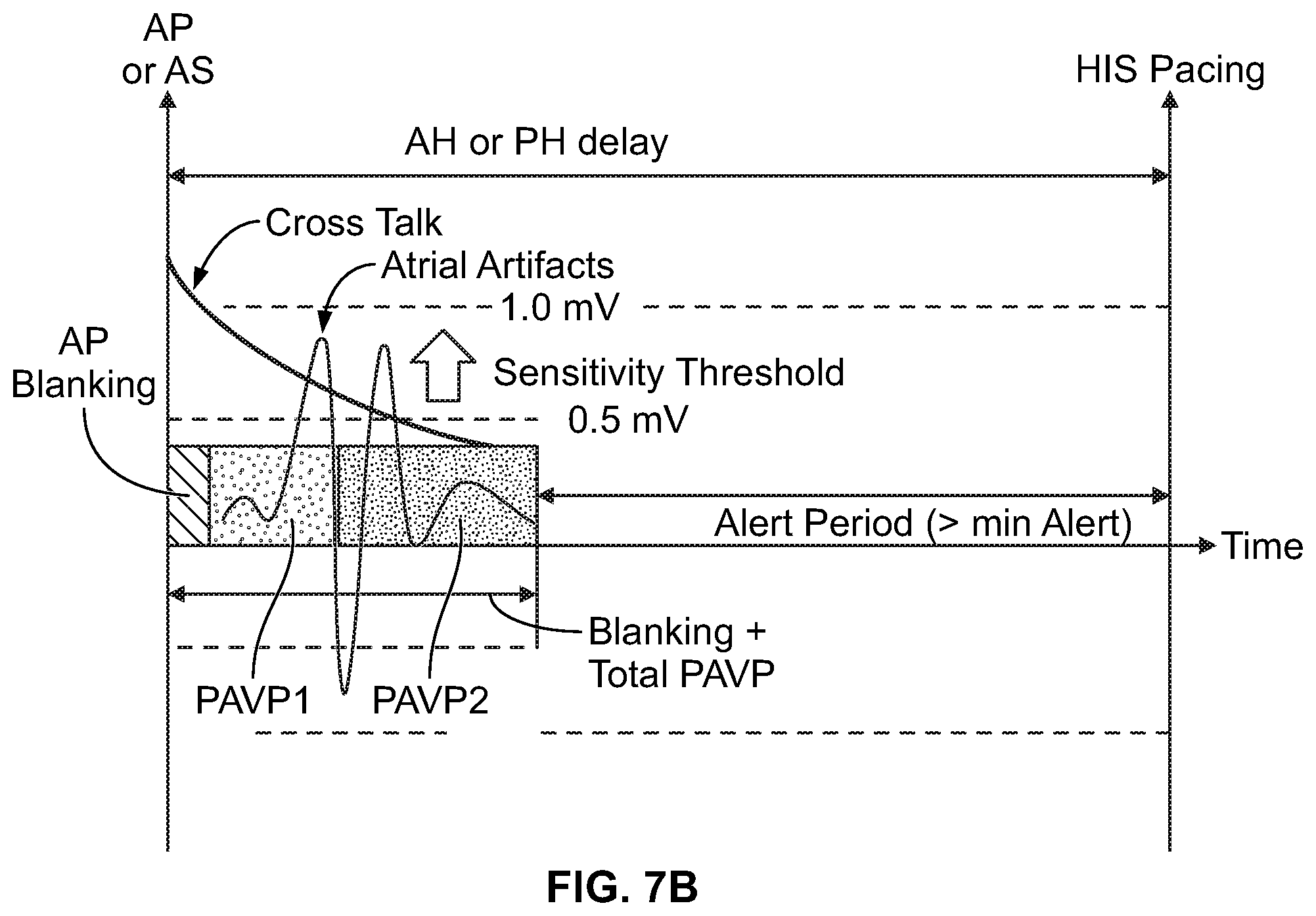 Patent US11779769 Figure 9 – Method and device for avoiding atrial activity oversensing on his sensing channel