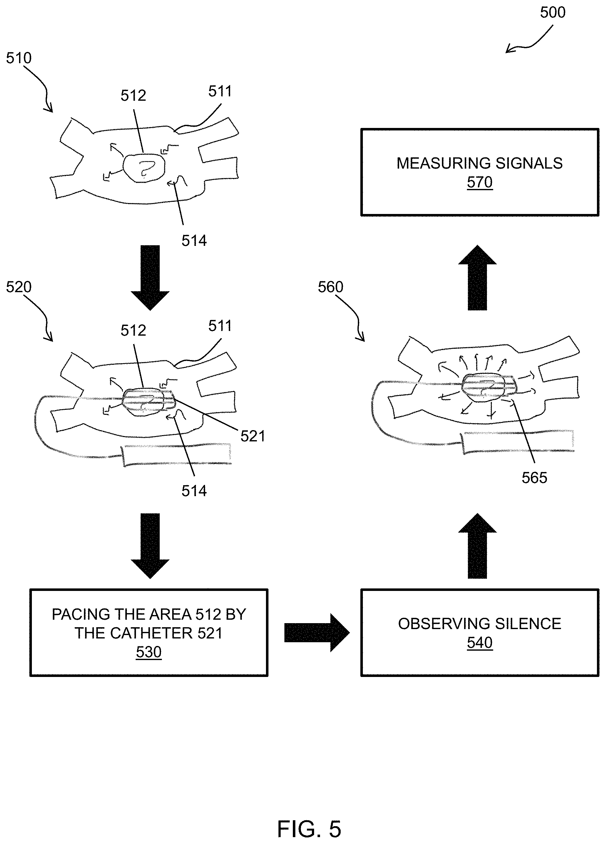 Patent US11779770 Figure 5 – Universal pacing of a catheter