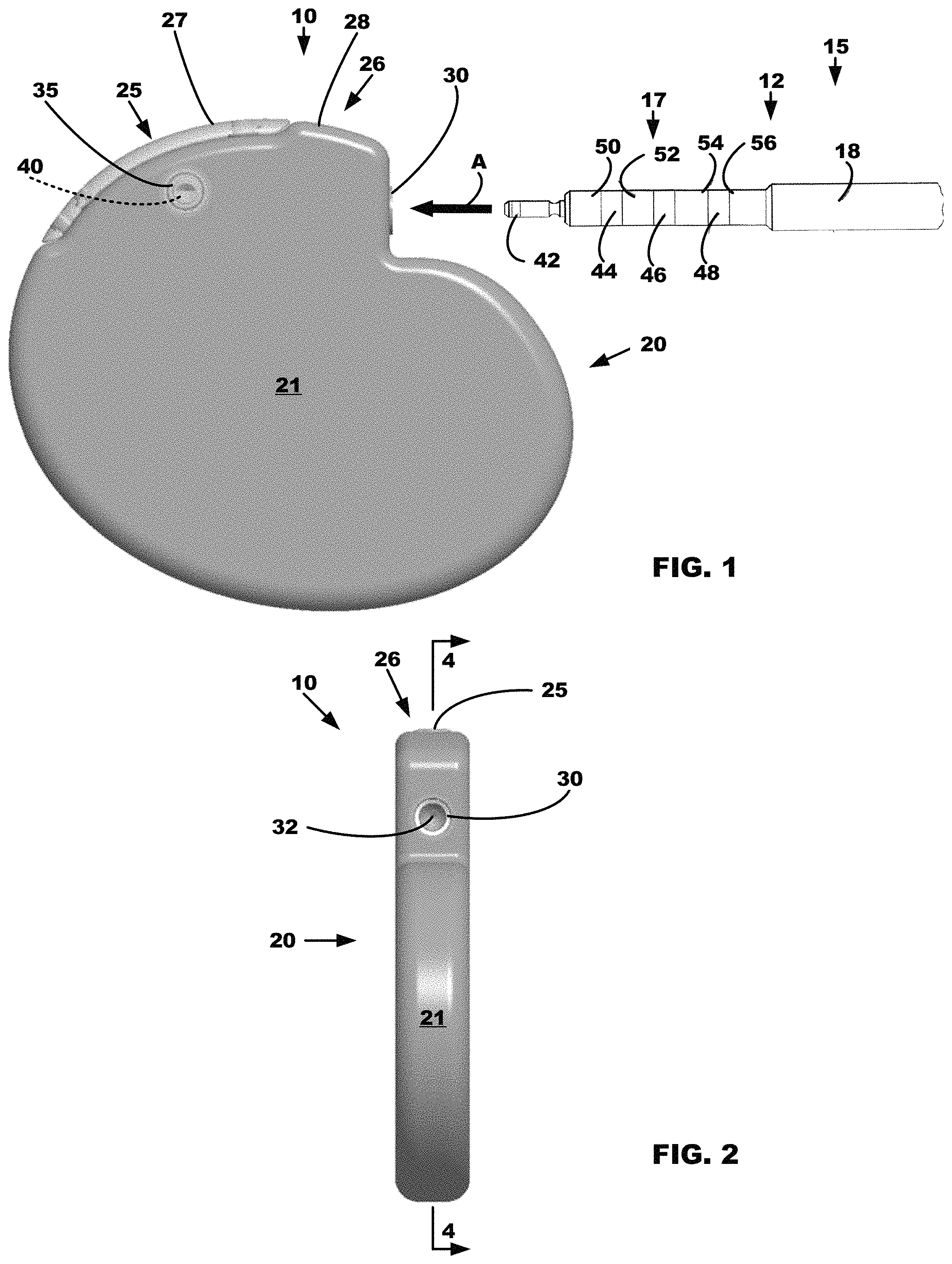 Patent US11779772 Figure 1 – All metal enclosed implantable medical device with external BLE antenna for RF telemetry