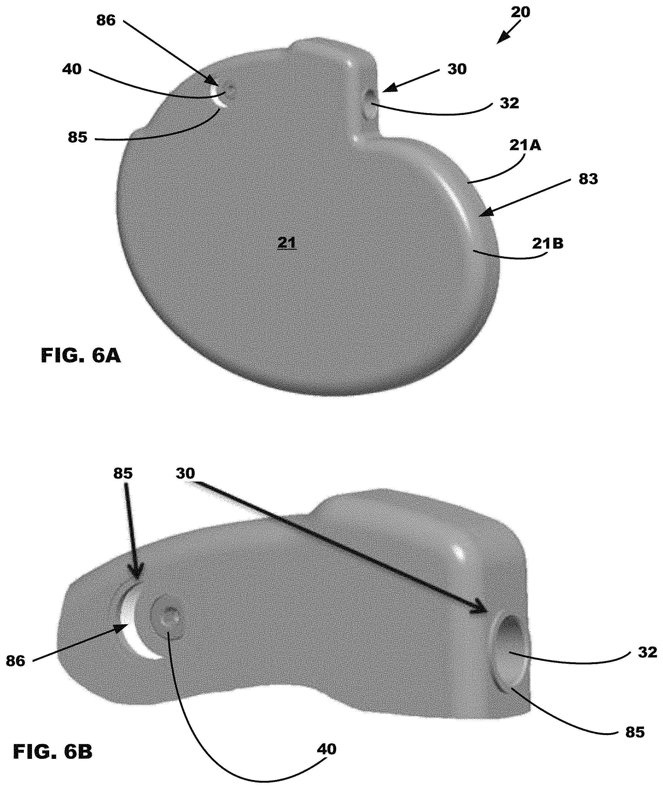 Patent US11779772 Figure 5 – All metal enclosed implantable medical device with external BLE antenna for RF telemetry