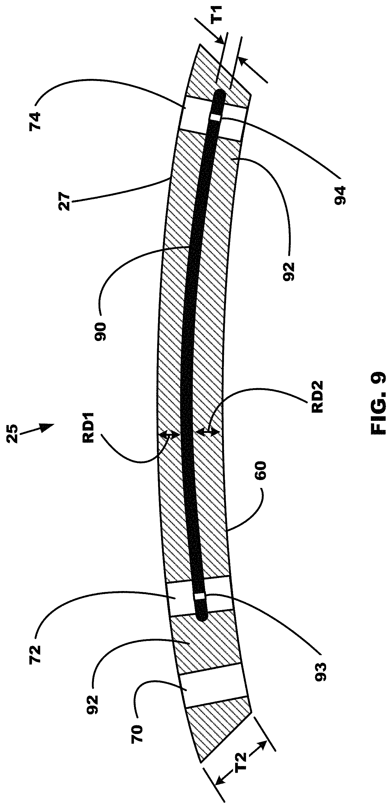 Patent US11779772 Figure 7 – All metal enclosed implantable medical device with external BLE antenna for RF telemetry