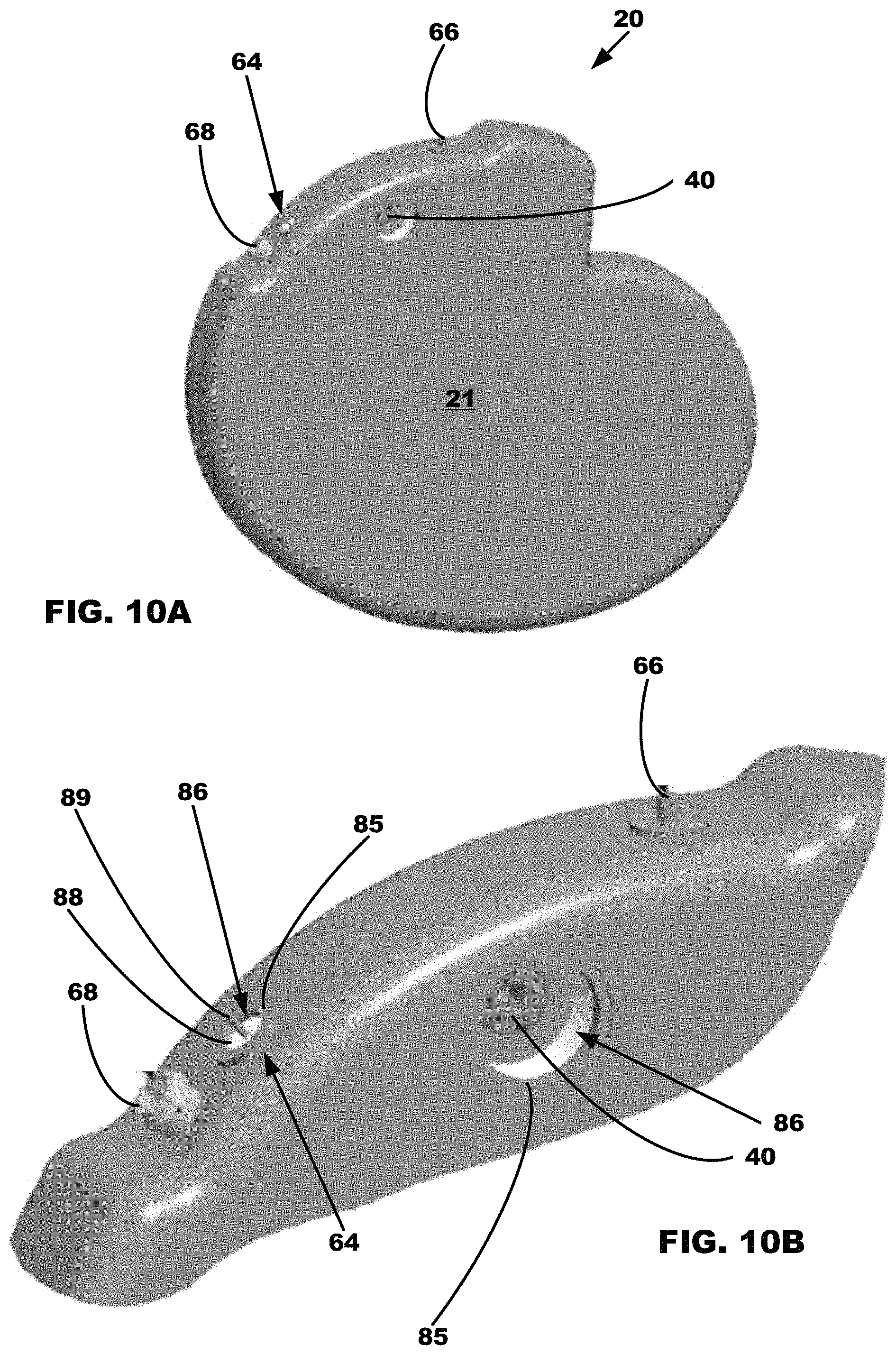Patent US11779772 Figure 8 – All metal enclosed implantable medical device with external BLE antenna for RF telemetry