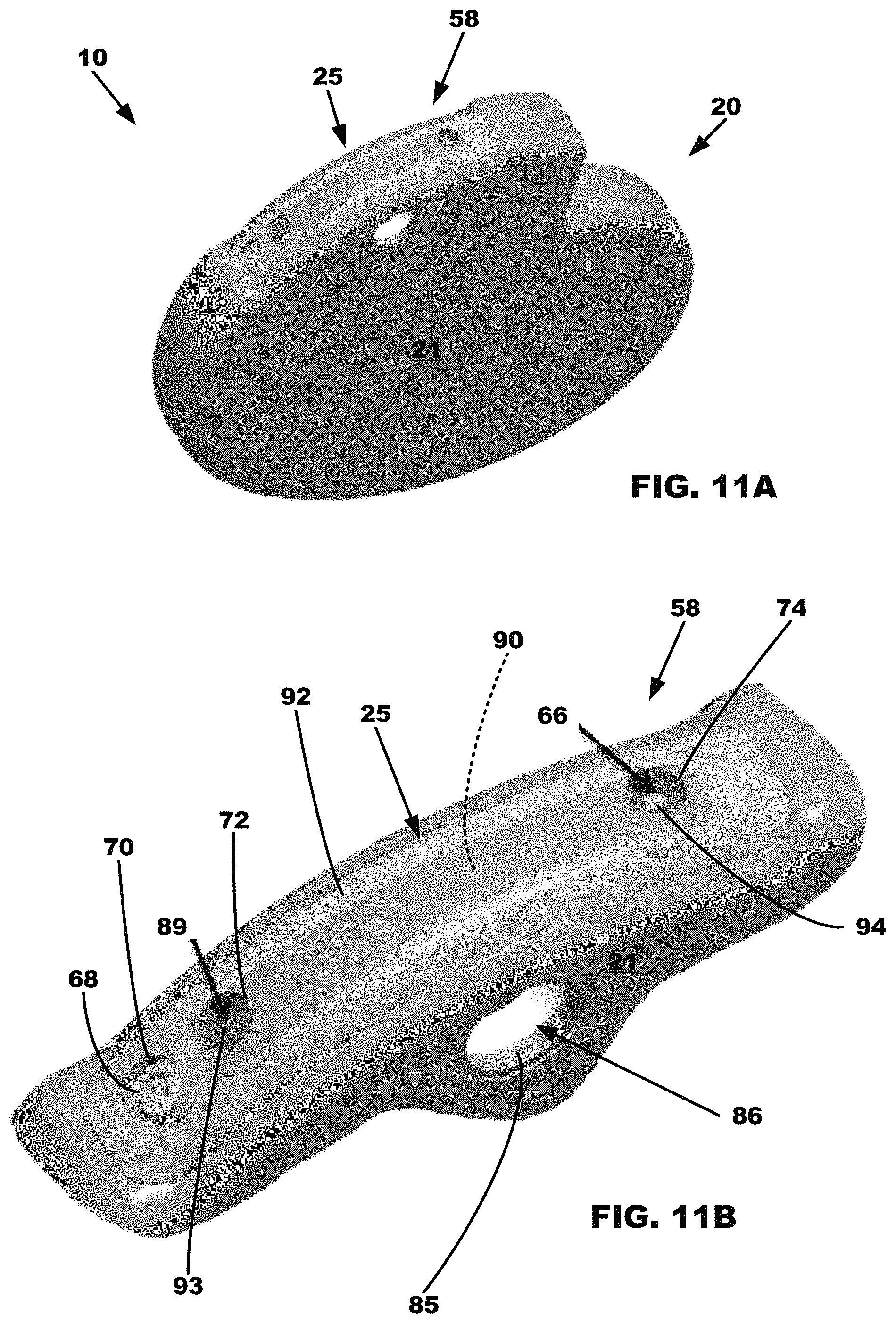 Patent US11779772 Figure 9 – All metal enclosed implantable medical device with external BLE antenna for RF telemetry