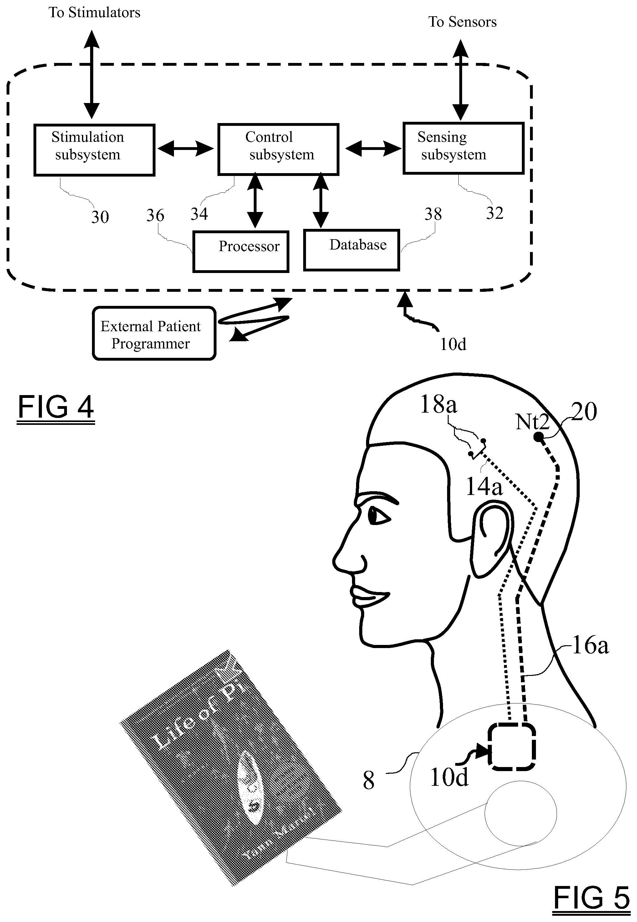 Patent US11779775 Figure 9 – Neurostimulation guided by brain network modeling