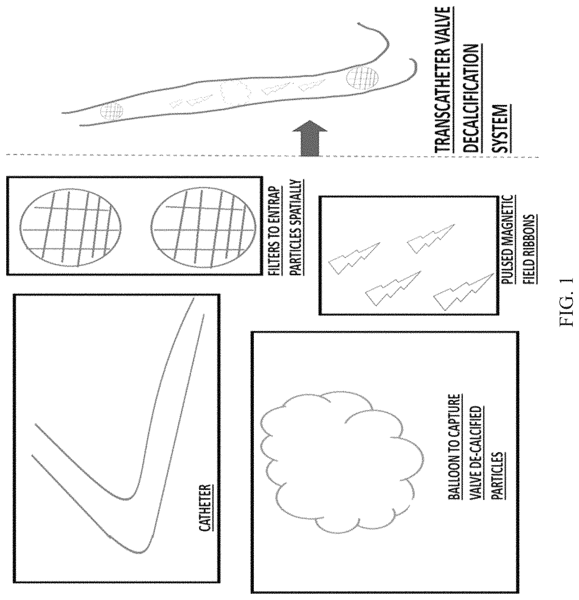 Patent US11779776 Figure 1 – Systems and methods for decalcifying cardiac valves and vessels