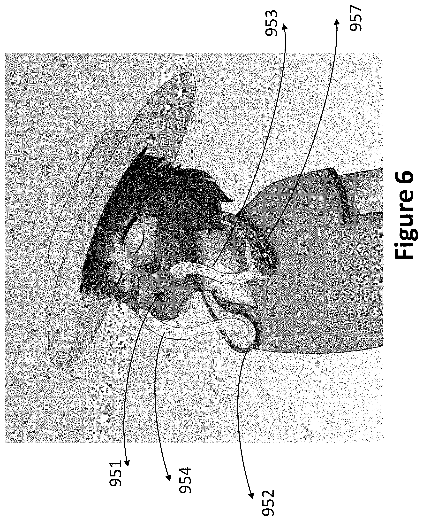 Patent US11779781 Figure 8 – Face mask with a neck hanger