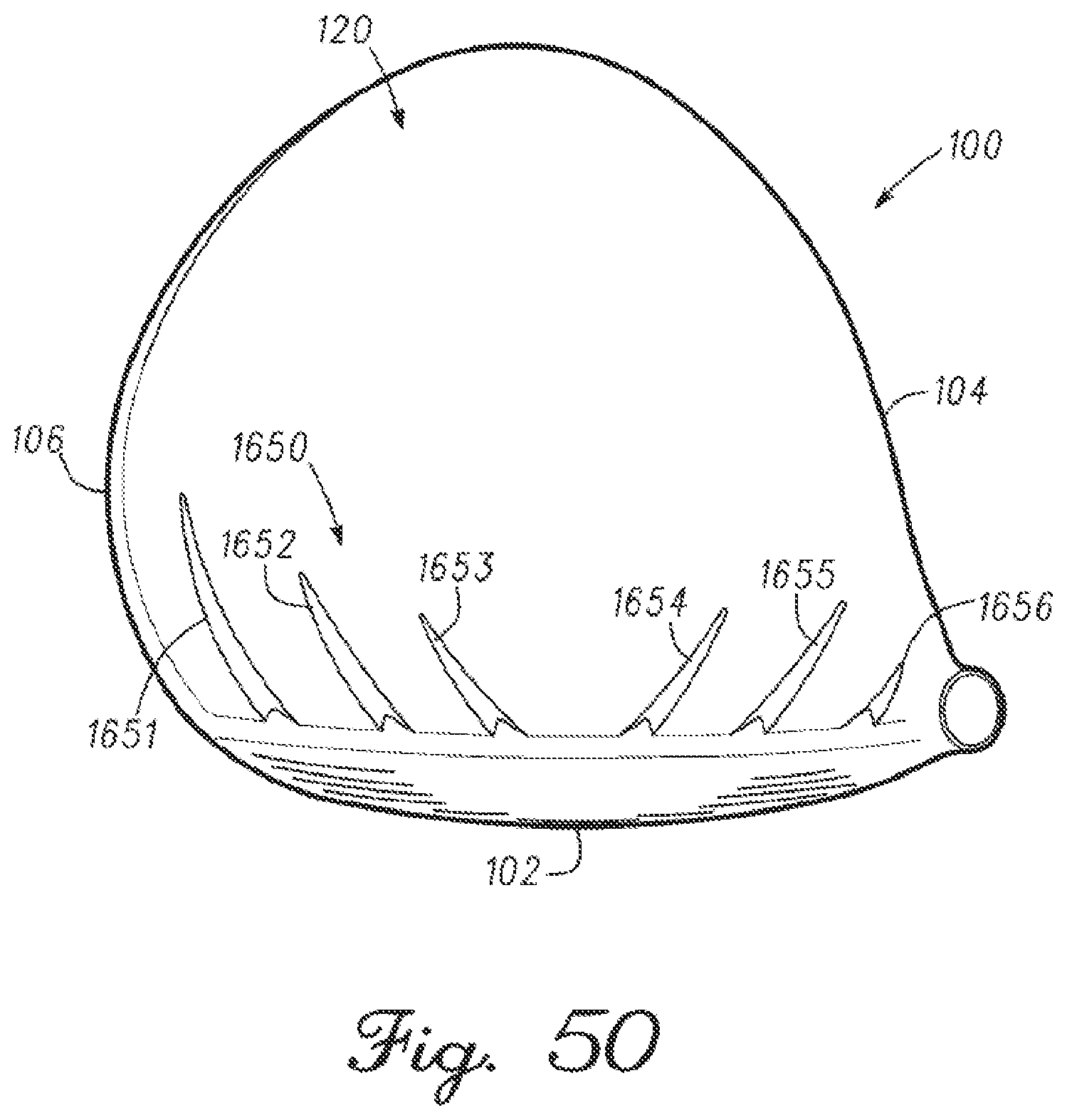 Patent US11779818 Figure 19 – Golf club heads with turbulators and methods to manufacture golf club heads with turbulators